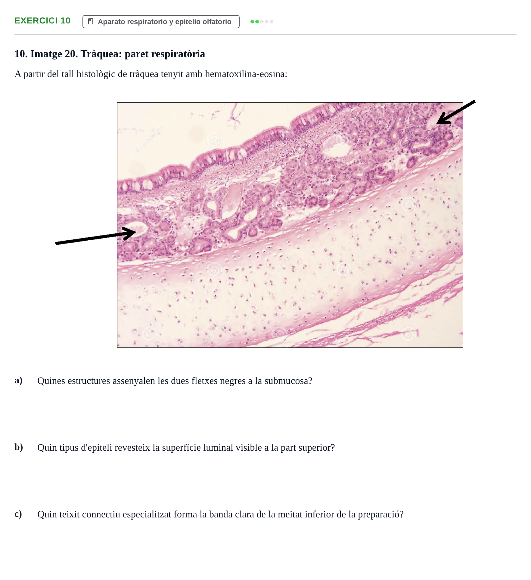 Enunciado: Problema 10 · Anatomia Microscòpica UDL 2020