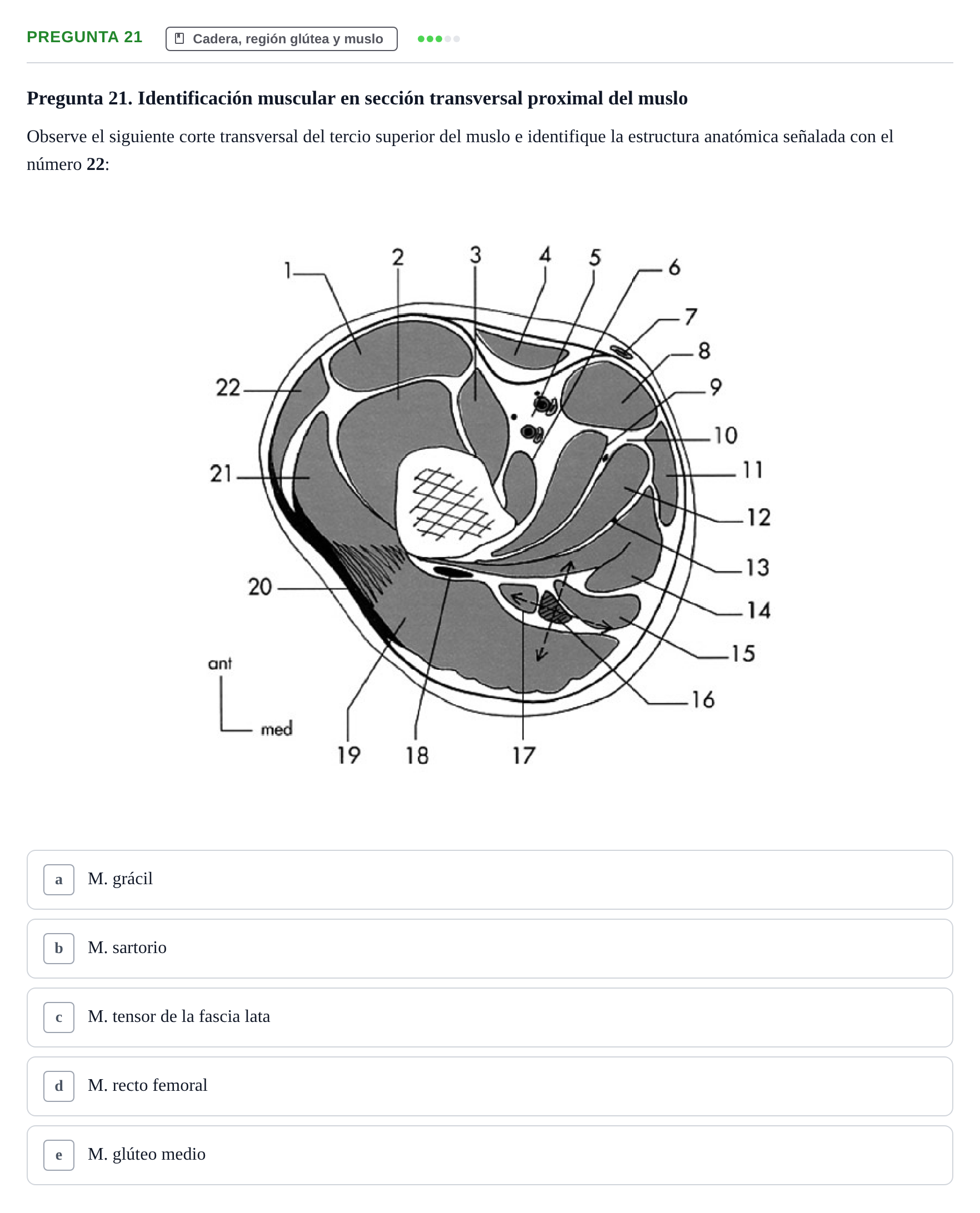 Enunciado: Pregunta 21 · Anatomía General y del Aparato Locomotor URV 2020
