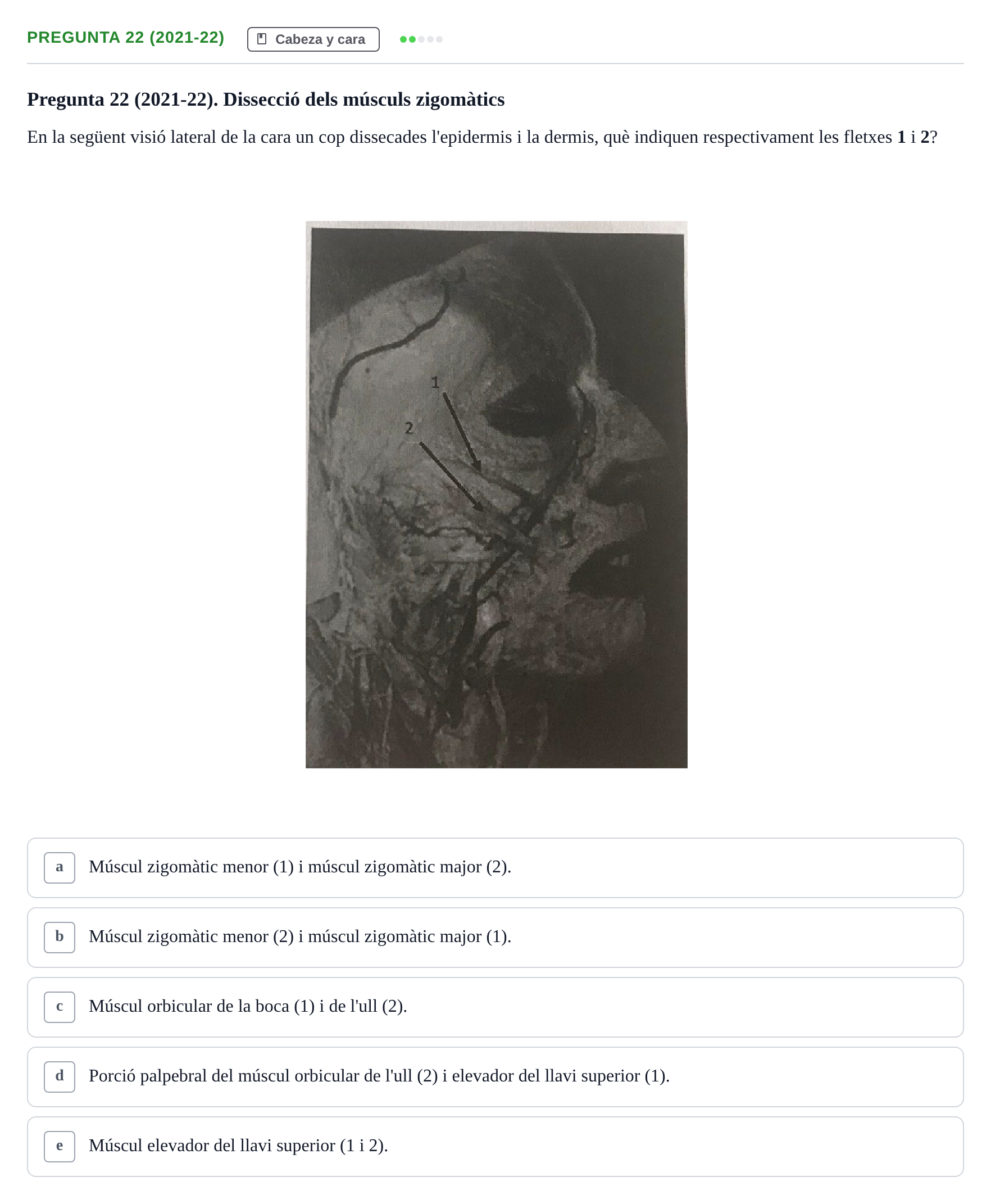 Enunciado: Pregunta 22 (2021-22) · Anatomía General y del Aparato Locomotor URV 2020
