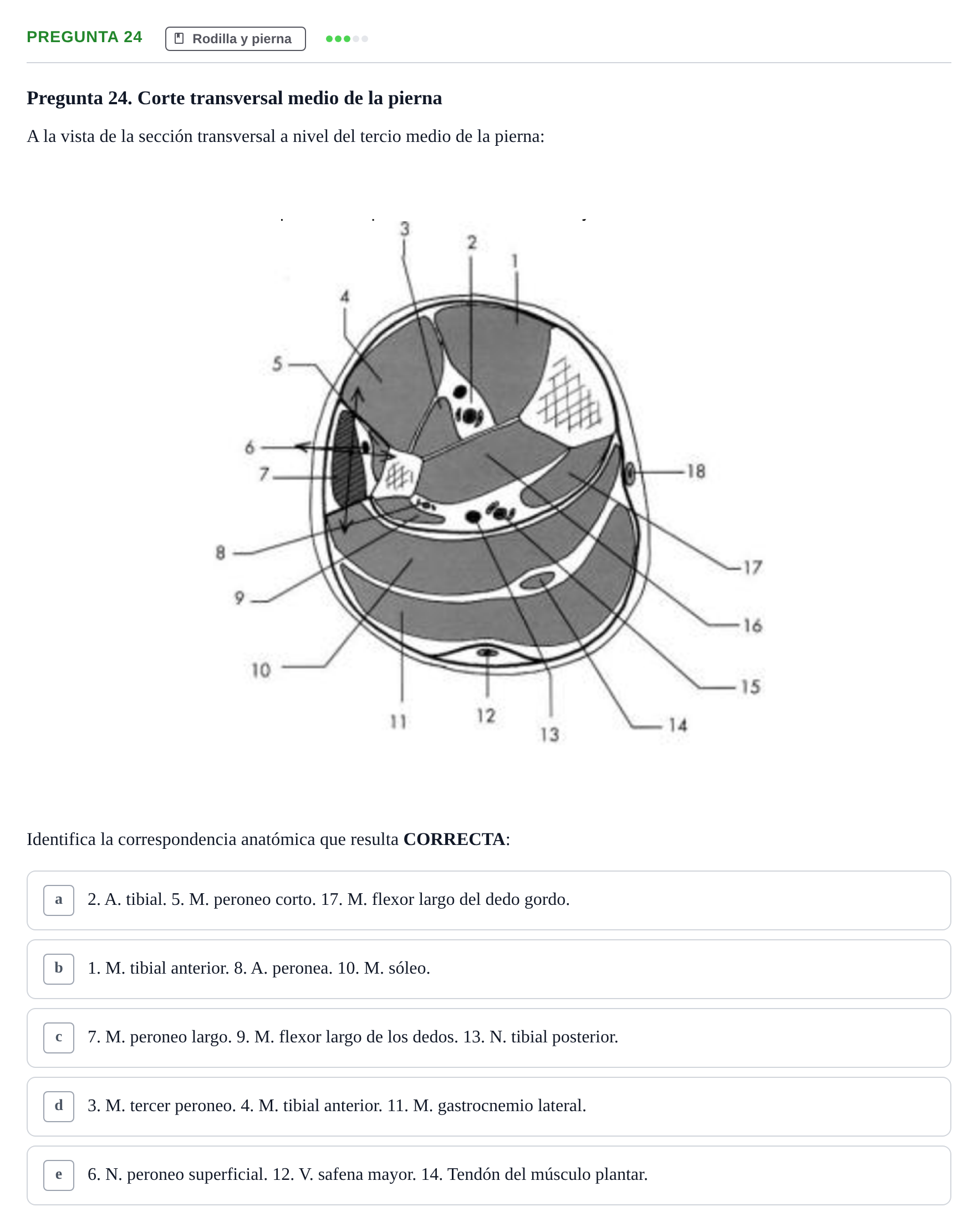 Enunciado: Pregunta 24 · Anatomía General y del Aparato Locomotor URV 2018