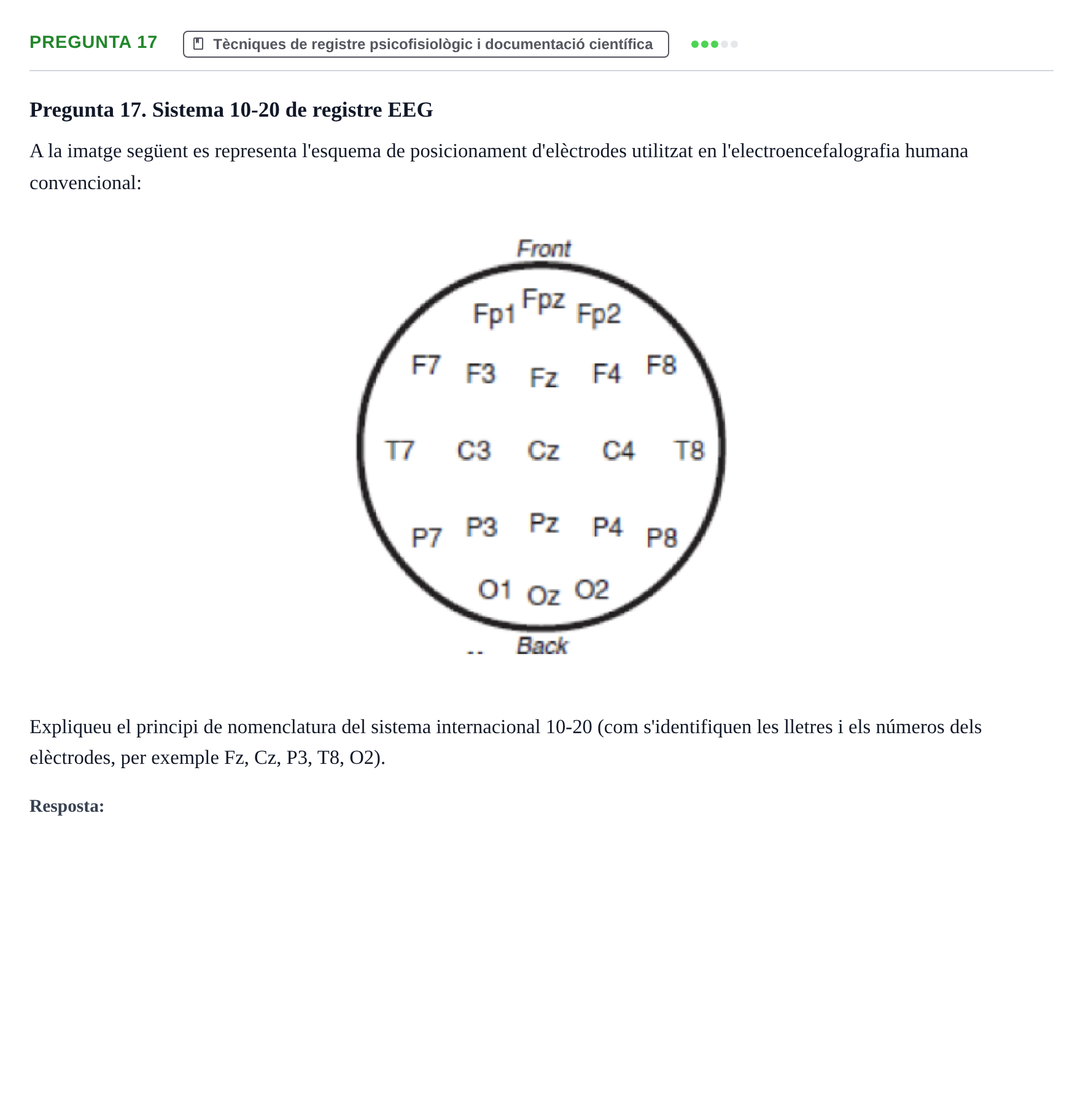 Enunciado: Pregunta 17 · Psicofisiología UB Examen Parcial Q2. Psicofisiologia