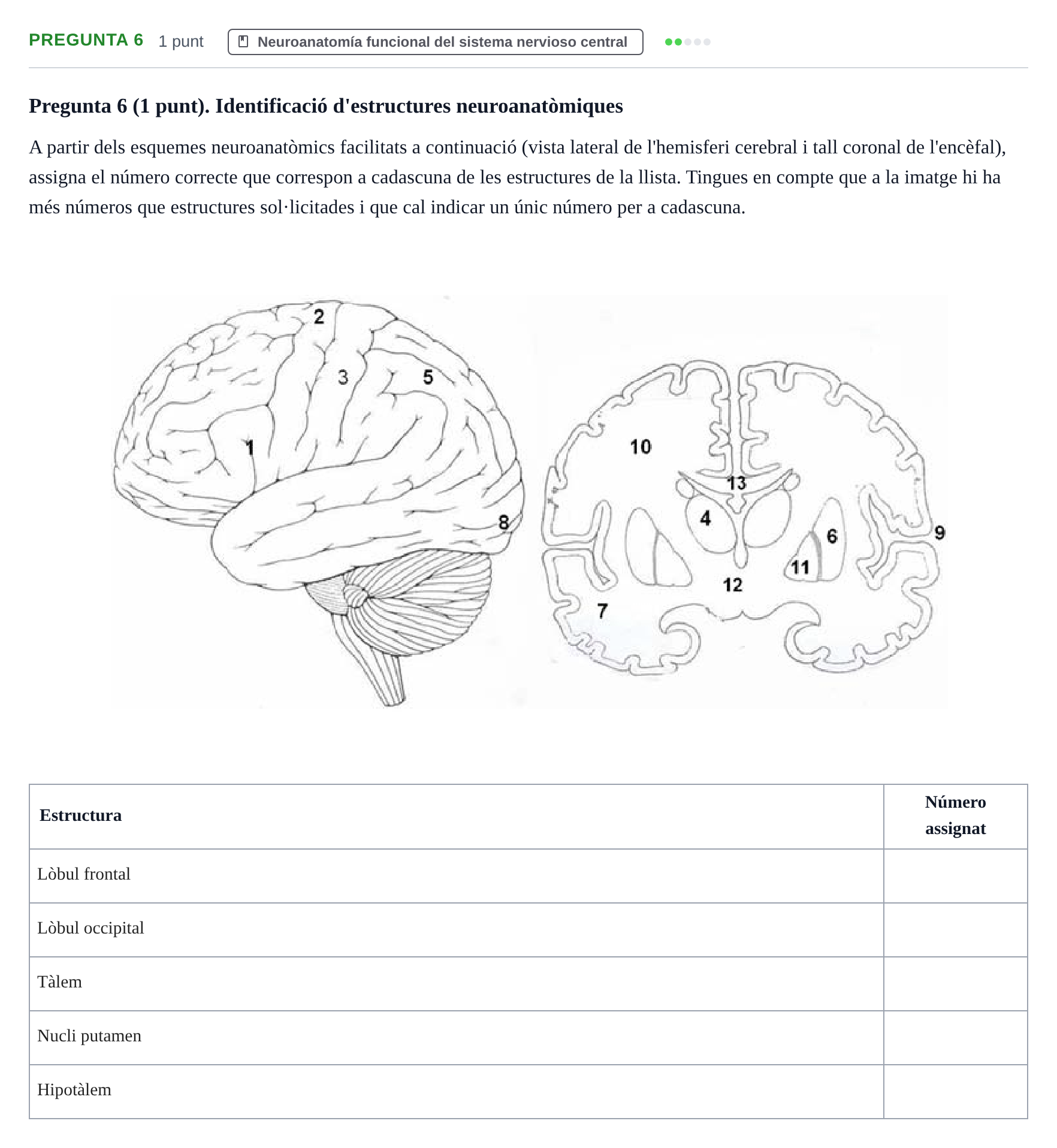 Enunciado: Pregunta 6 · Psicobiologia I UOC 2013