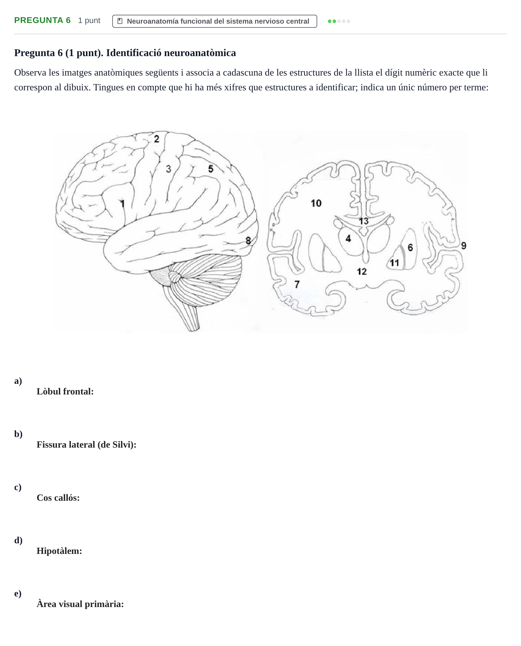 Enunciado: Pregunta 6 · Psicobiologia I UOC 2013