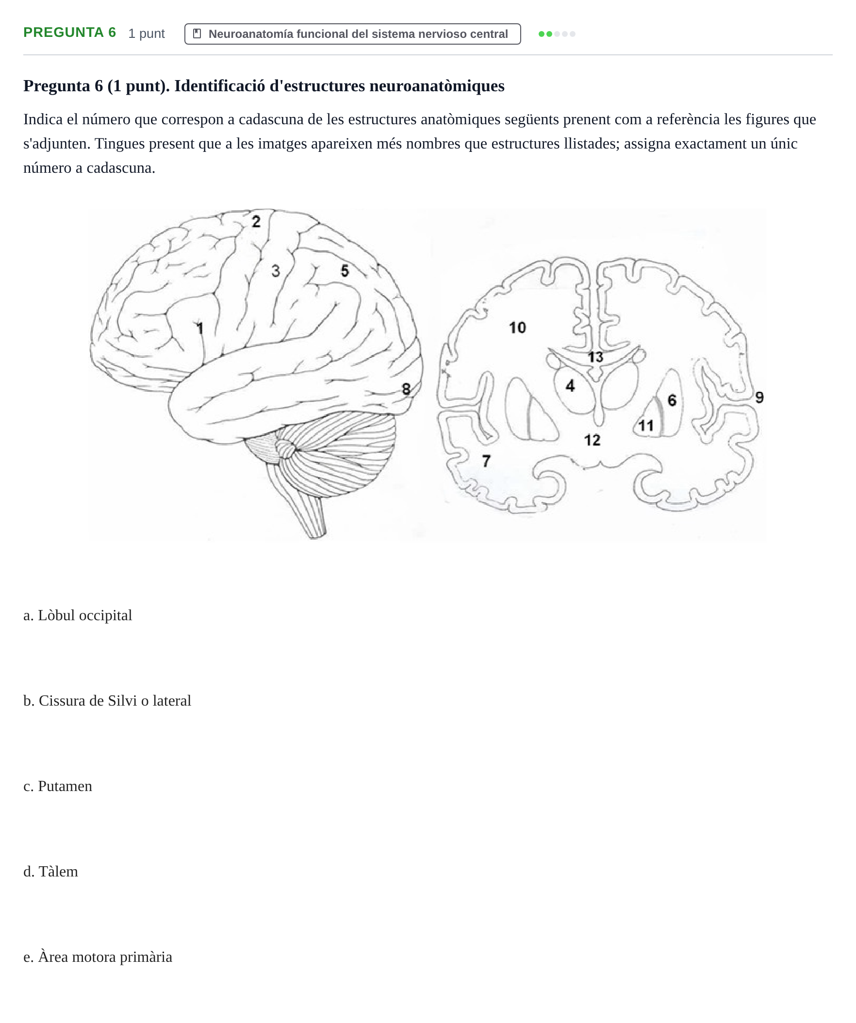 Enunciado: Pregunta 6 · Psicobiologia I UOC 2013
