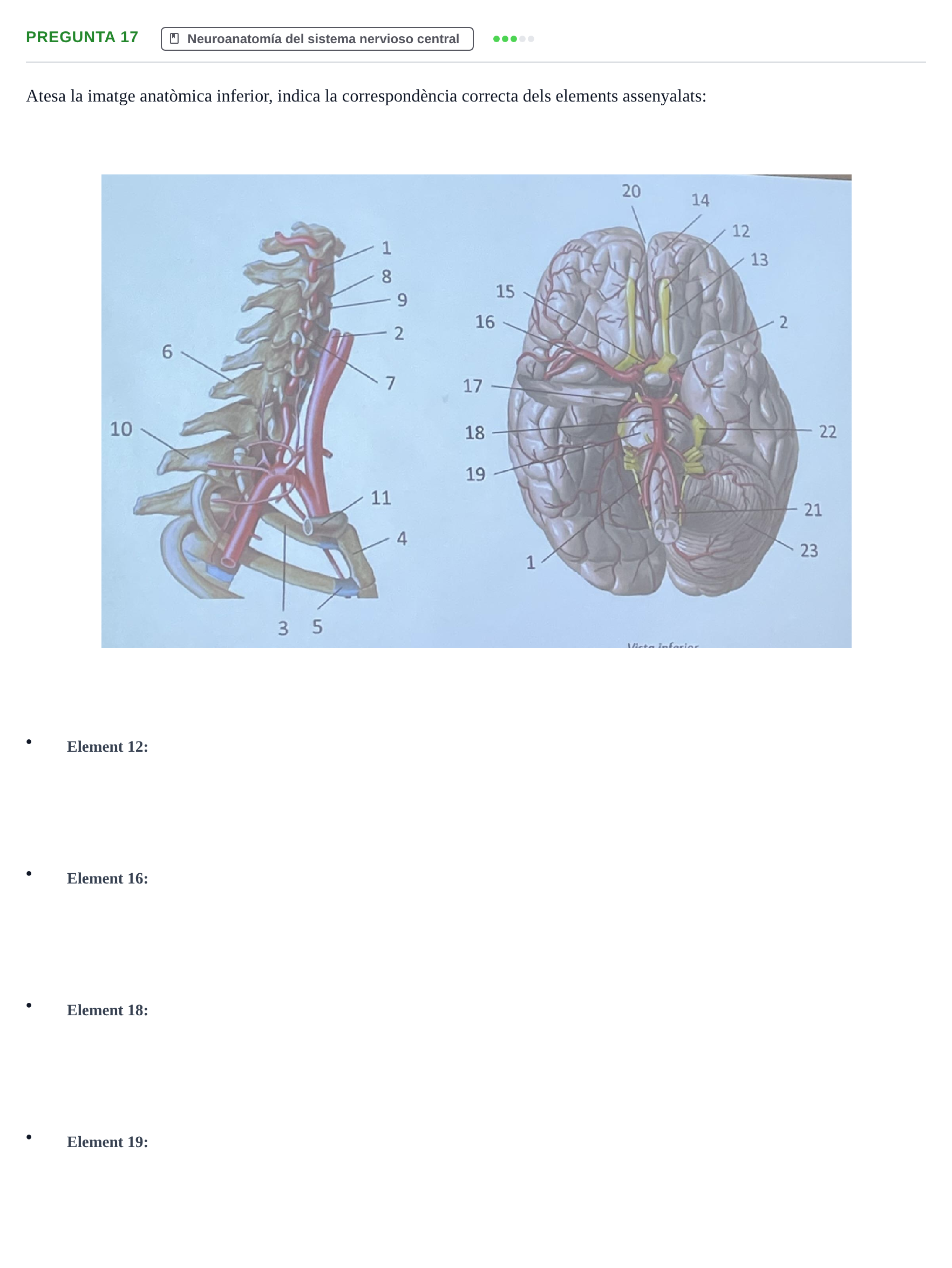 Enunciado: Pregunta 17 · Anatomía Humana UB Examen 1. Anatomia Humana