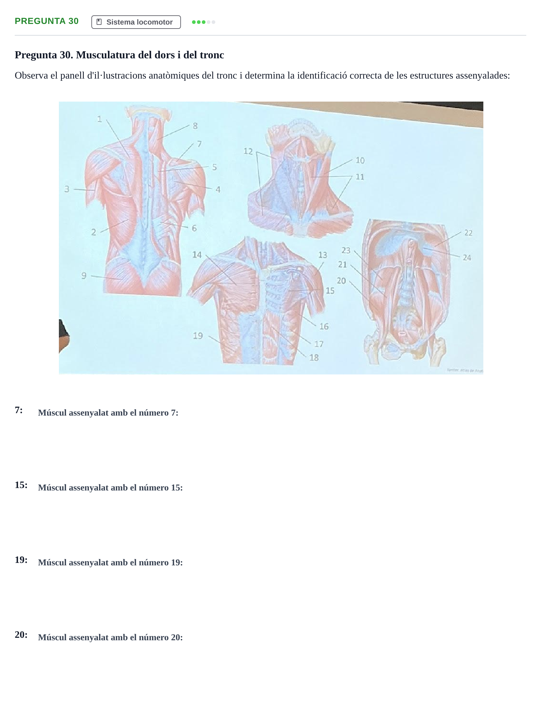 Enunciado: Pregunta 30 · Anatomía Humana UB Examen 1. Anatomia Humana