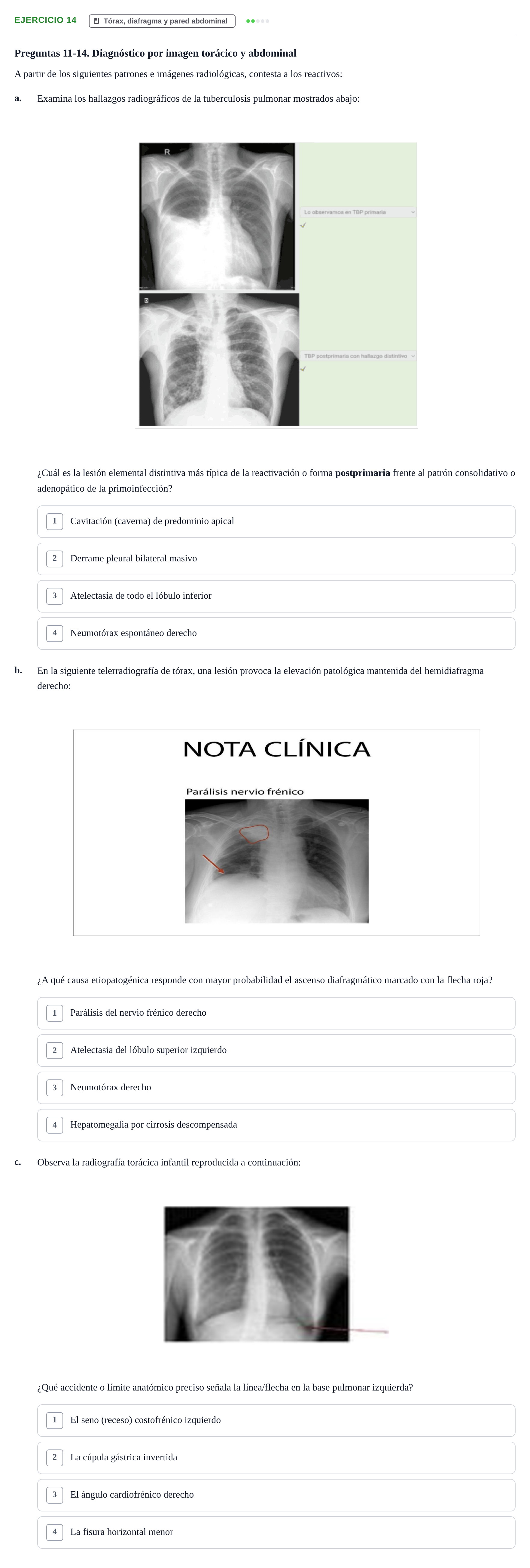 Enunciado: 14 - Tórax, diafragma y pared abdominal