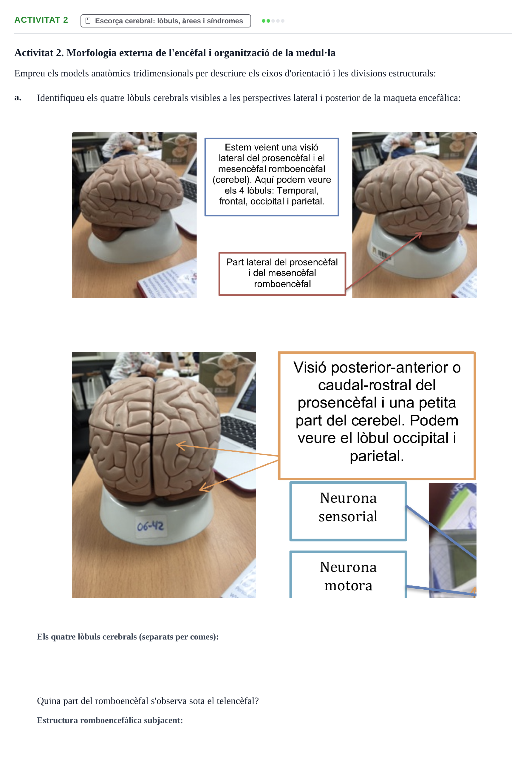 Enunciado: Activitat 2 - Escorça cerebral: lòbuls, àrees i s…