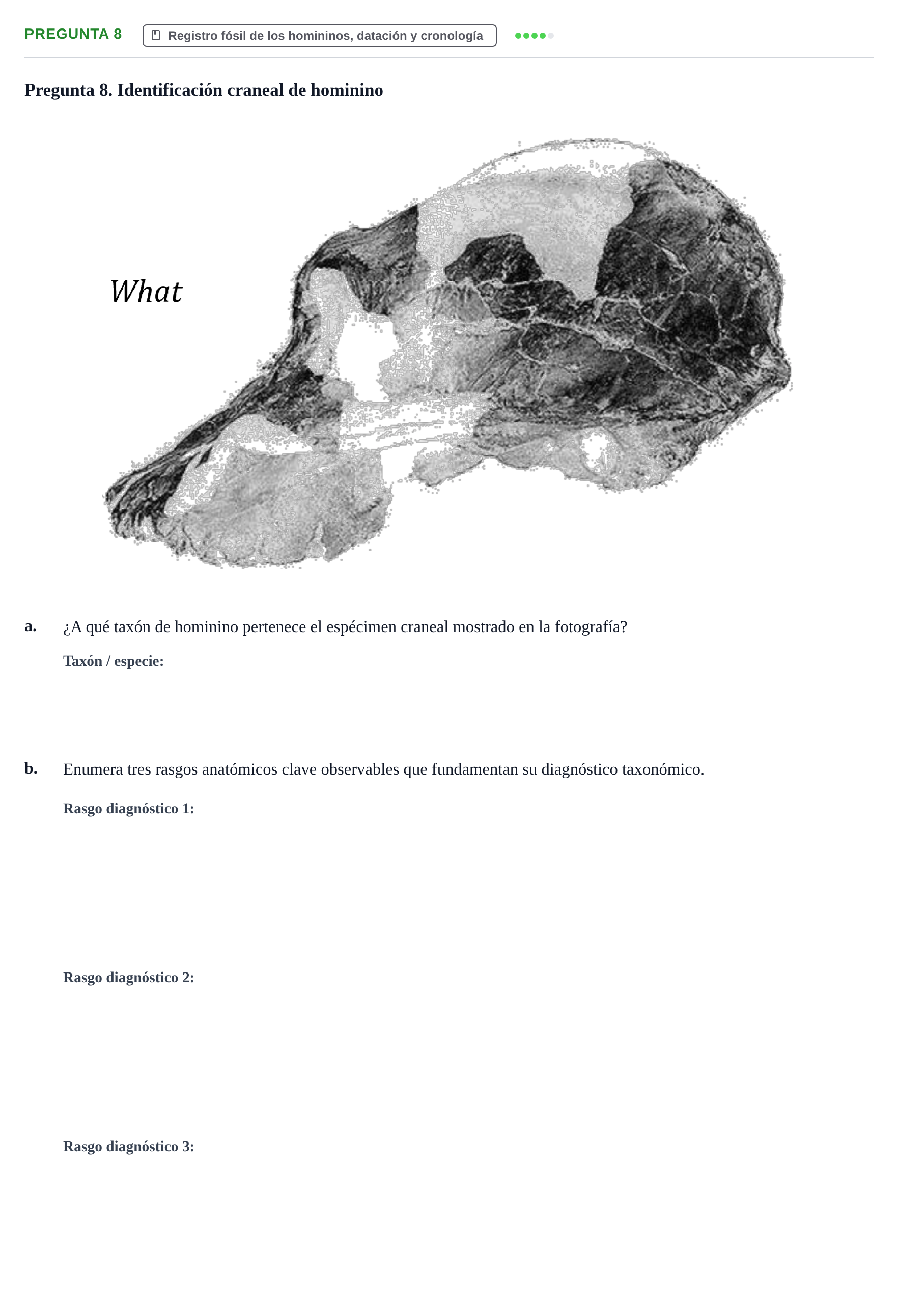 Enunciado: Pregunta 8 · Antropología Biológica UB 2015