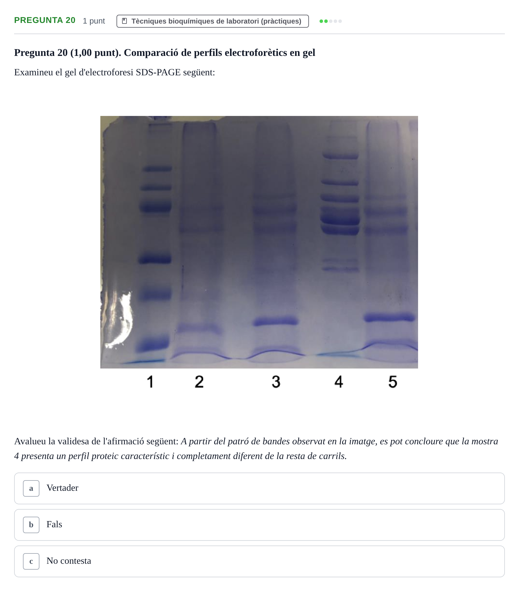 Enunciado: Pregunta 20 · Bioquímica UB Examen de pràctiques de laboratori: Cinètica enzimàtica i electroforesi de proteïnes
