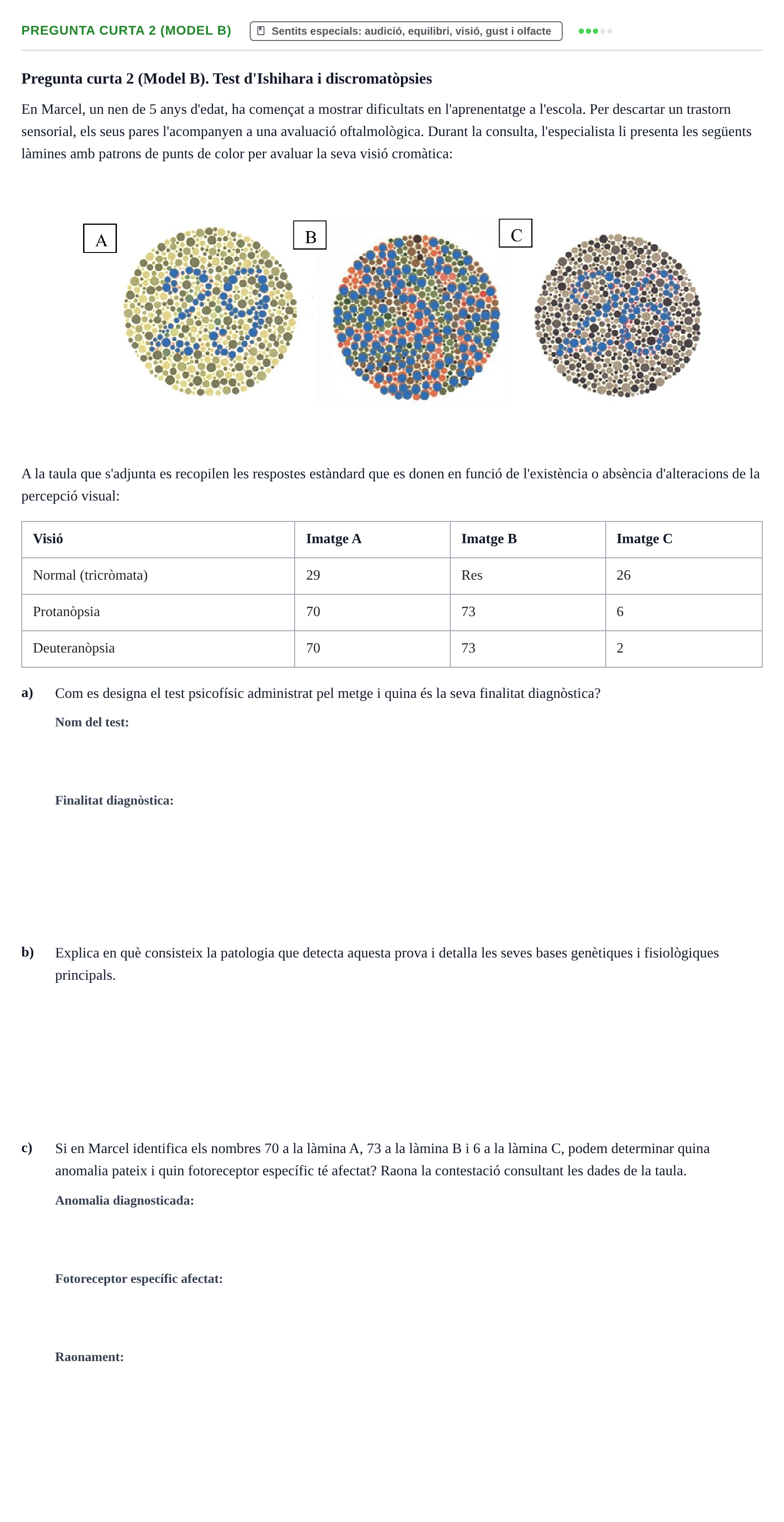 Enunciado: Pregunta curta 2 (Model B) · Fisiología y Fisiopatología I UB 2017