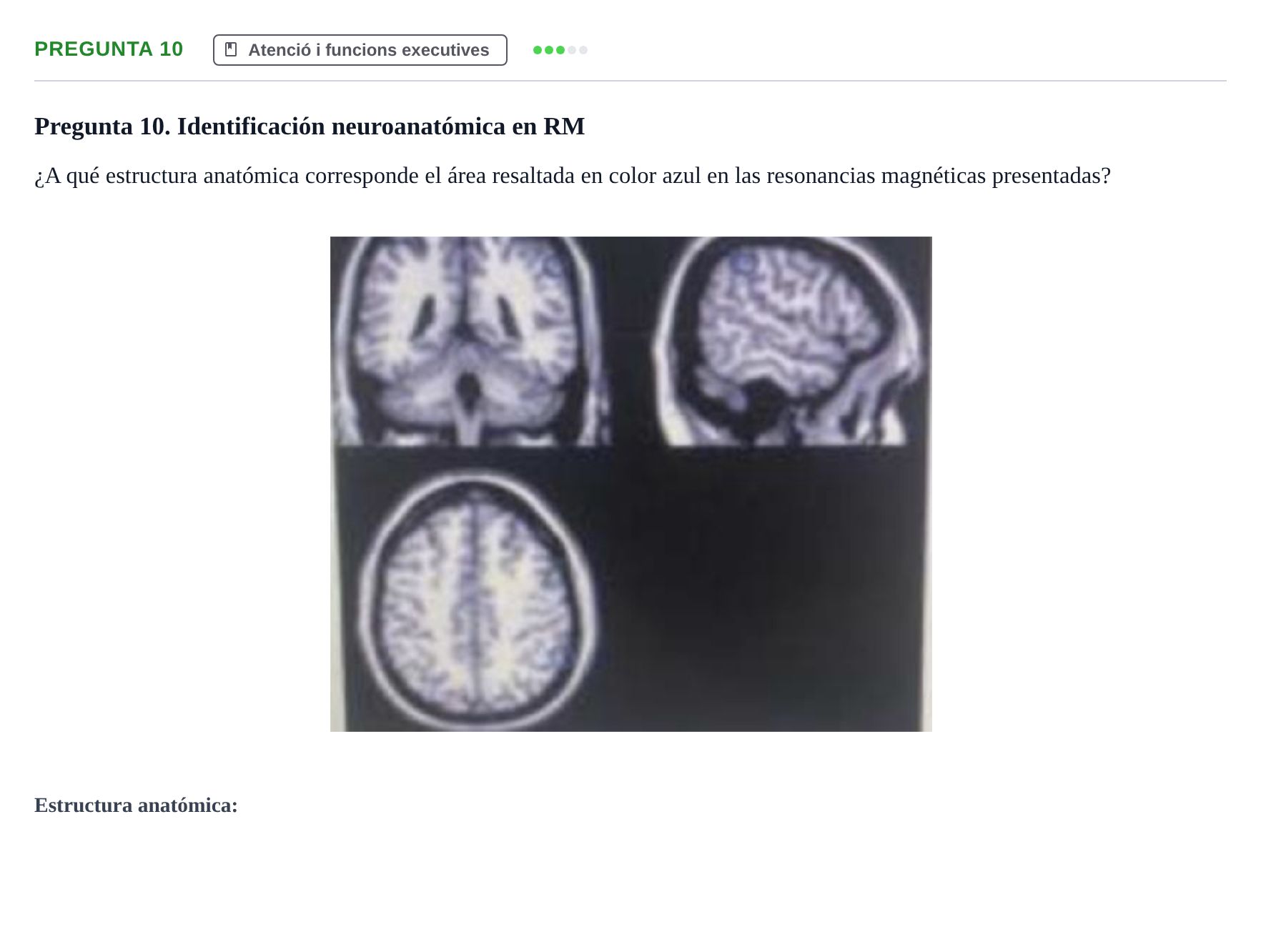 Enunciado: Pregunta 10 · Psicobiología UB Examen Segon Parcial de Psicobiología