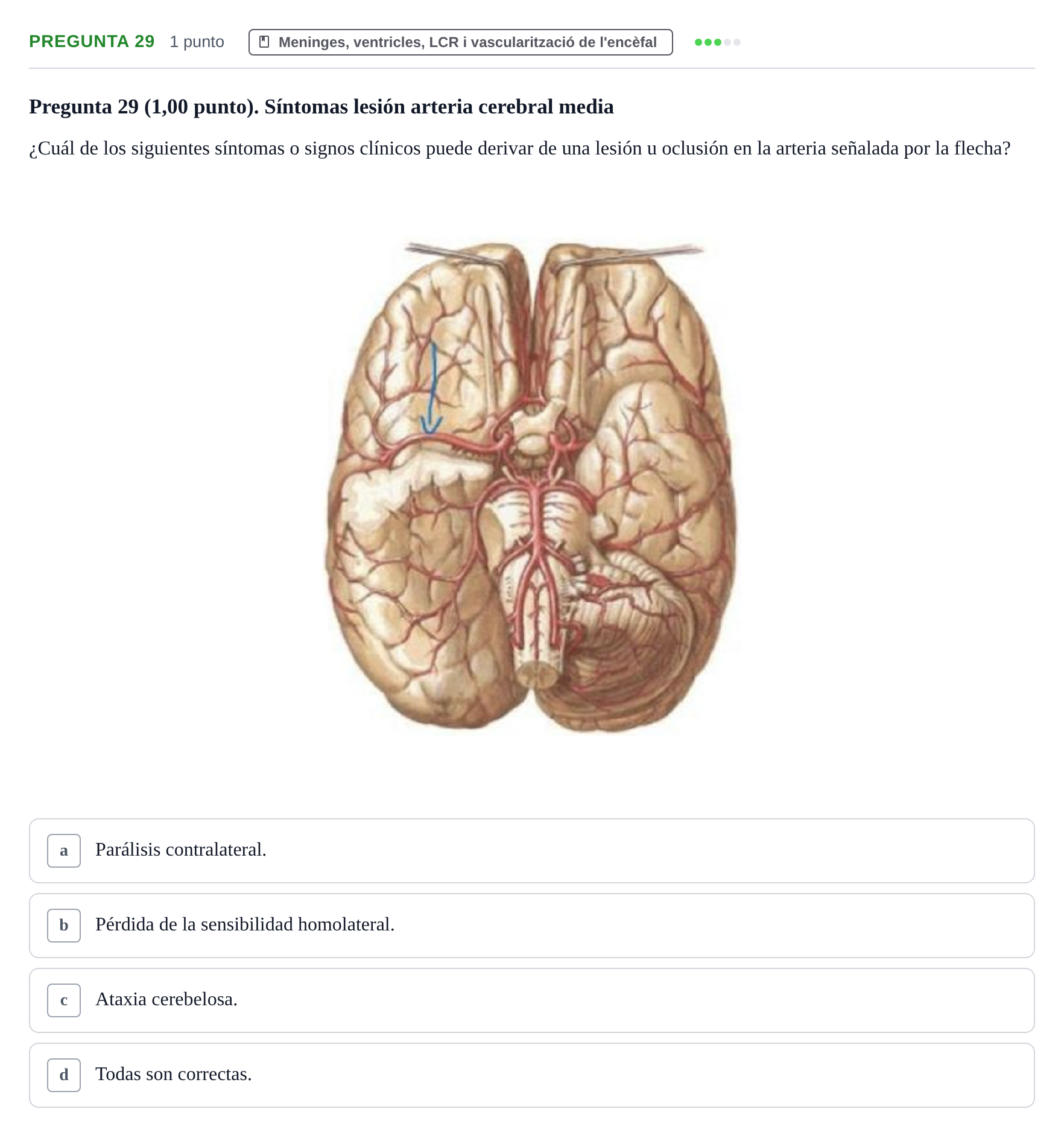 Enunciado: Pregunta 29 · Anatomía II UAB 2023