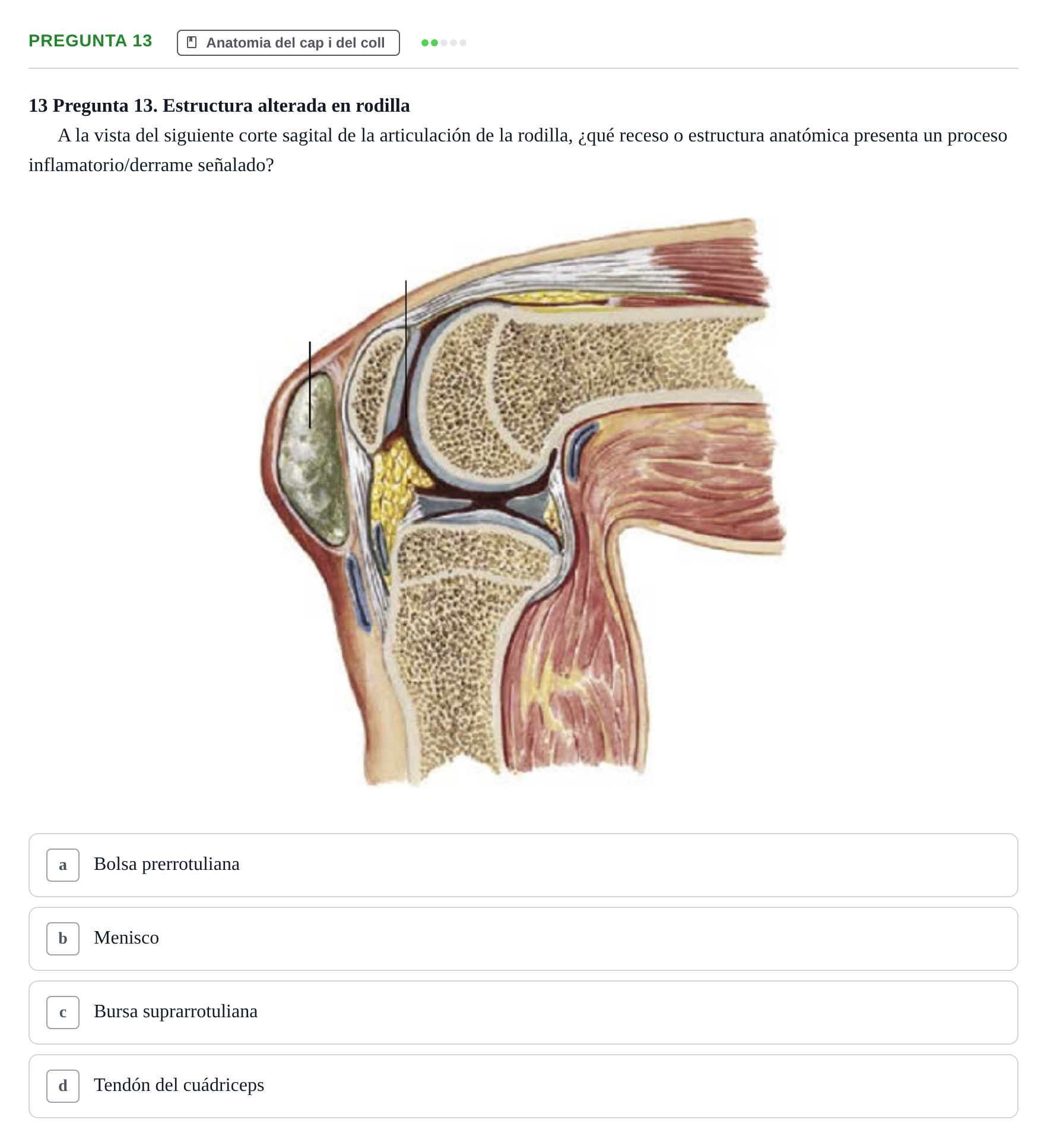 Enunciado: Pregunta 13 · Anatomía II UAB Examen de Anatomía II: Neuroanatomía y Miembro Inferior