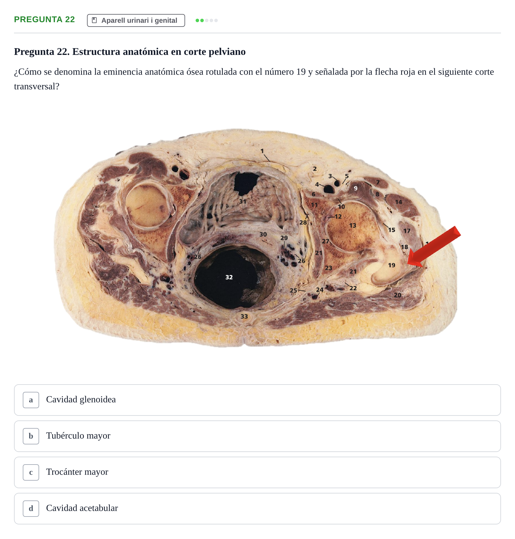 Enunciado: Pregunta 22 · Anatomía II UAB Examen de Anatomía II: Neuroanatomía y Miembro Inferior
