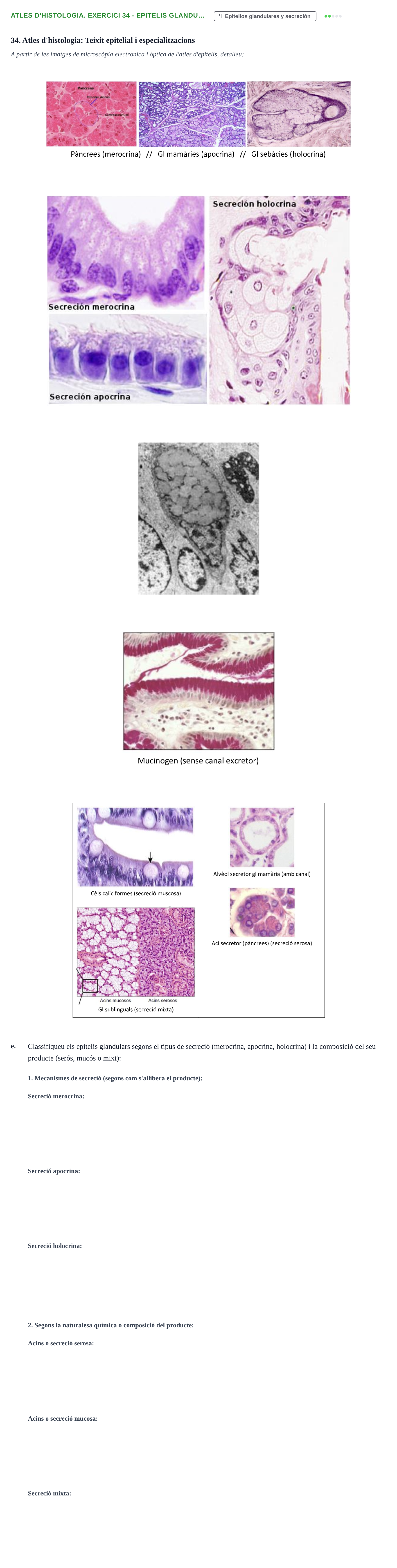 Enunciado: Atles d'histologia. Exercici 34 - Epitelis glandu…