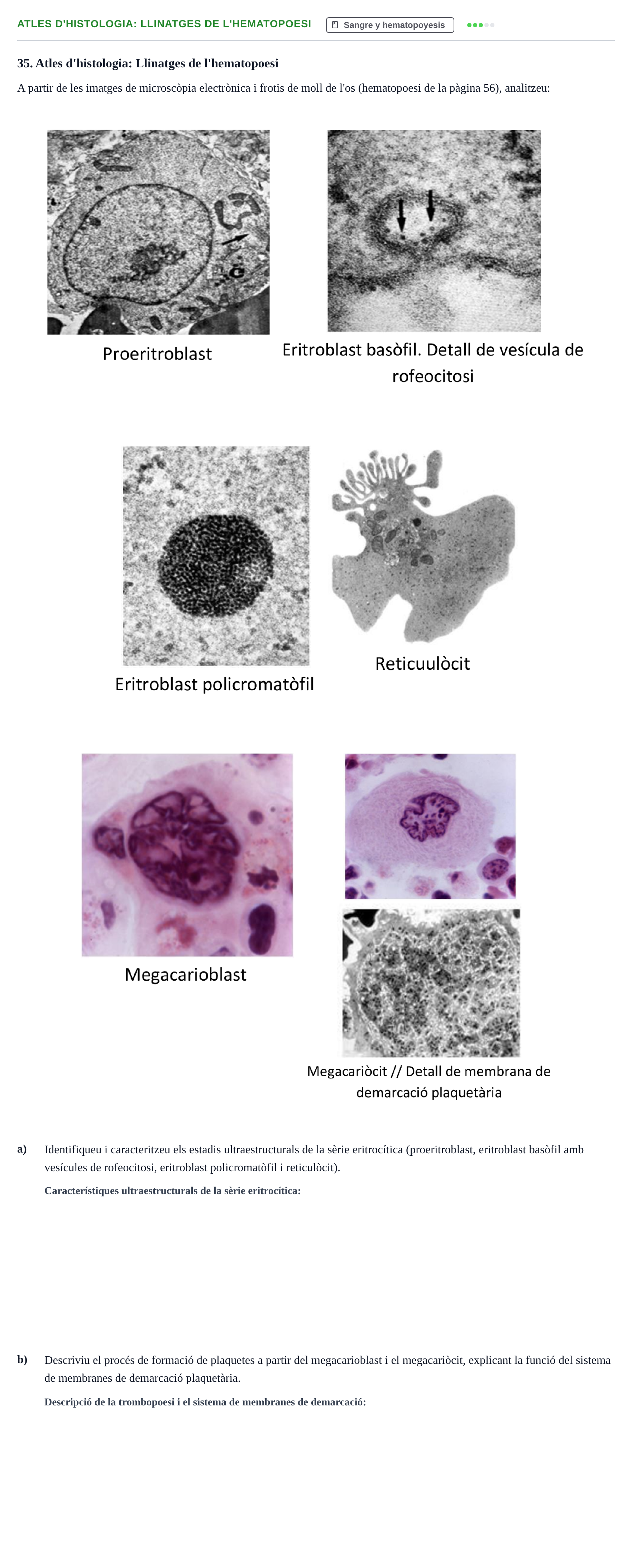 Enunciado: Atles d'histologia: Llinatges de l'hematopoesi