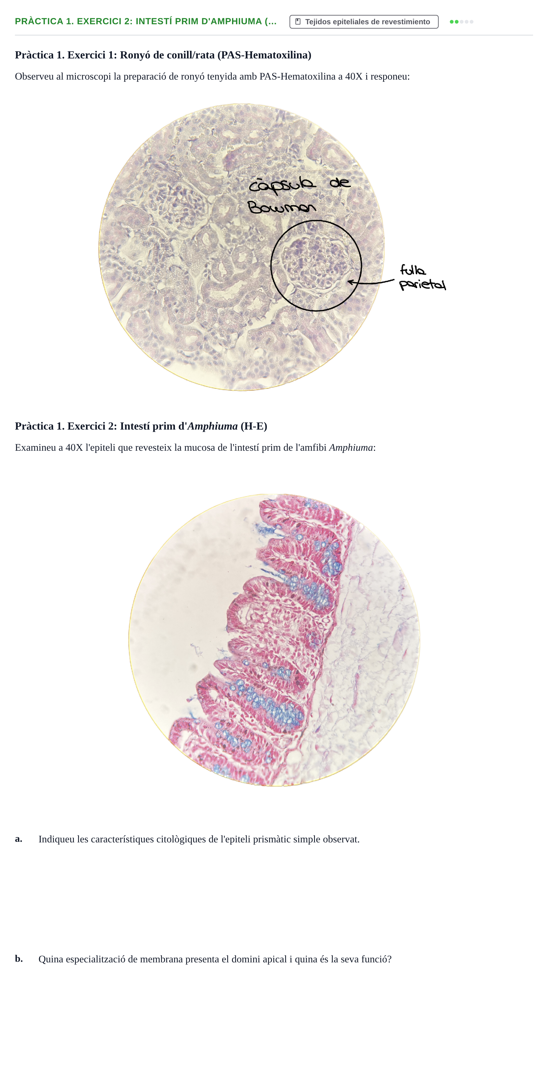 Enunciado: Pràctica 1. Exercici 2: Intestí prim d'Amphiuma (…