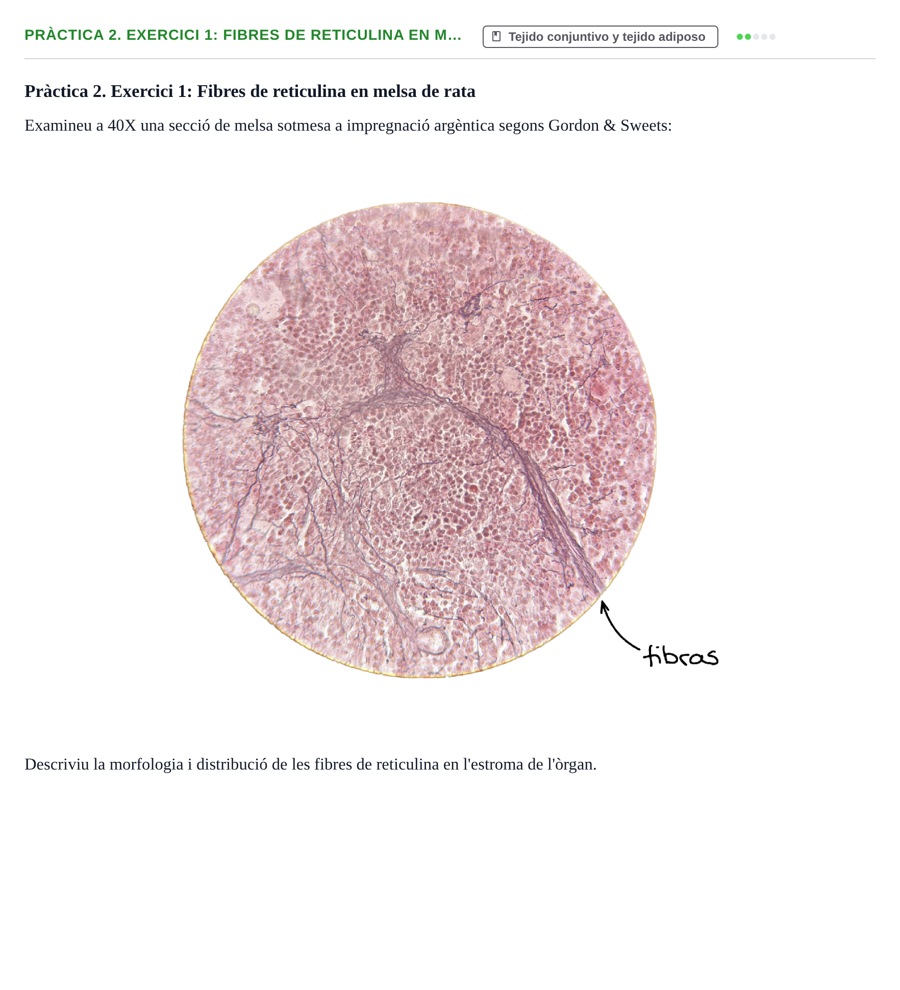 Enunciado: Pràctica 2. Exercici 1: Fibres de reticulina en m…