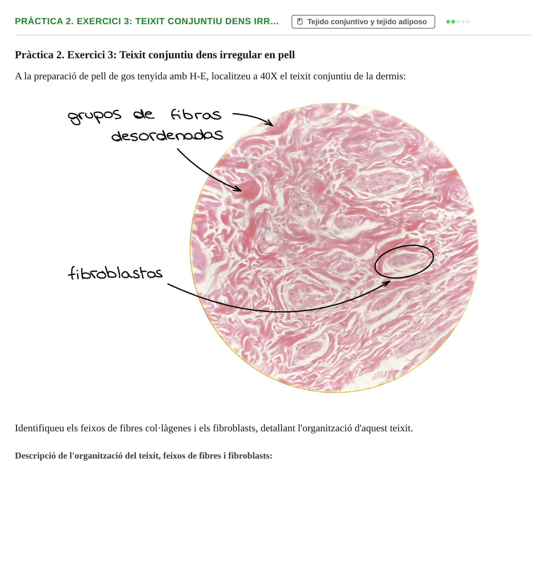 Enunciado: Pràctica 2. Exercici 3: Teixit conjuntiu dens irr…