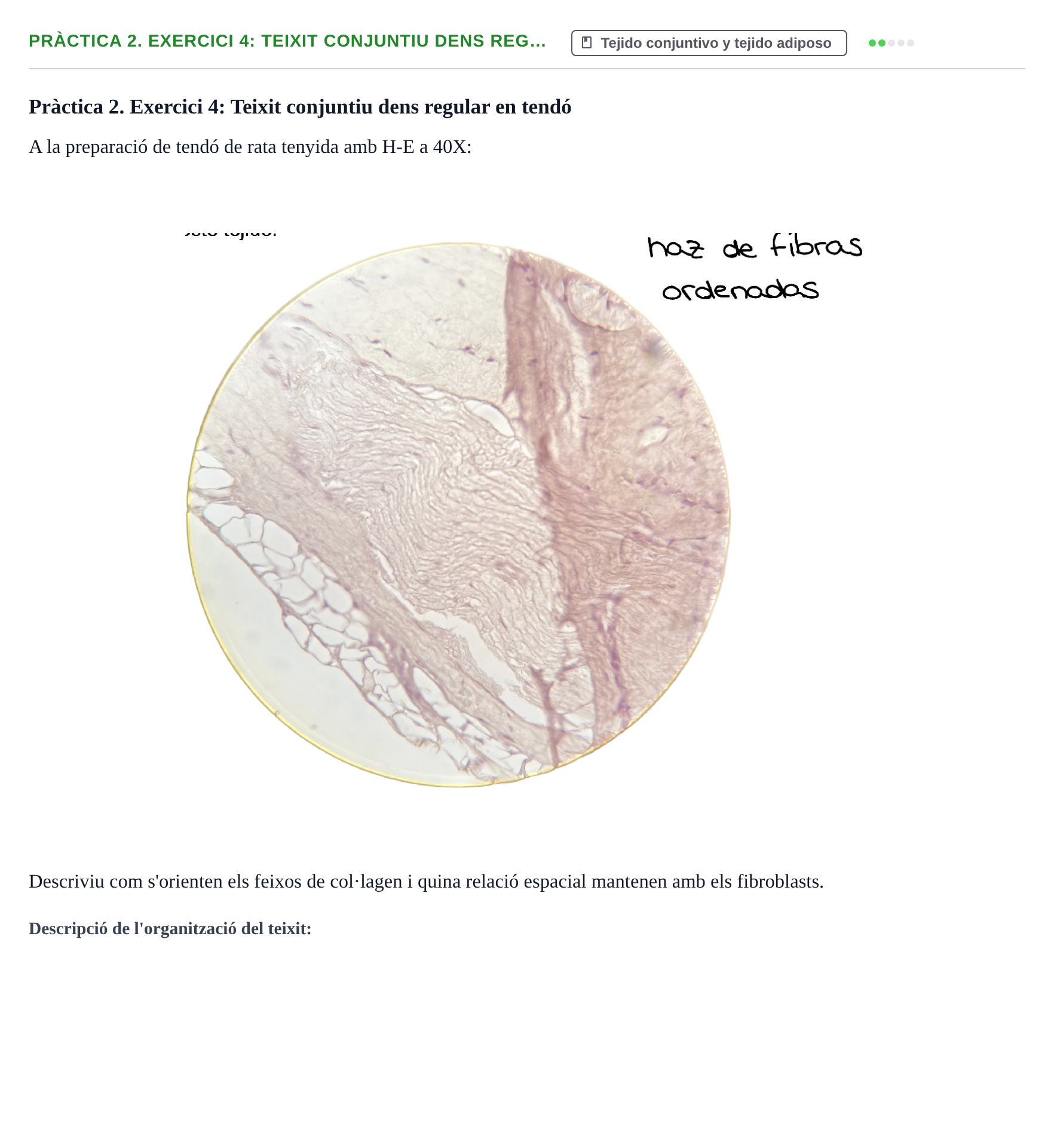 Enunciado: Pràctica 2. Exercici 4: Teixit conjuntiu dens reg…