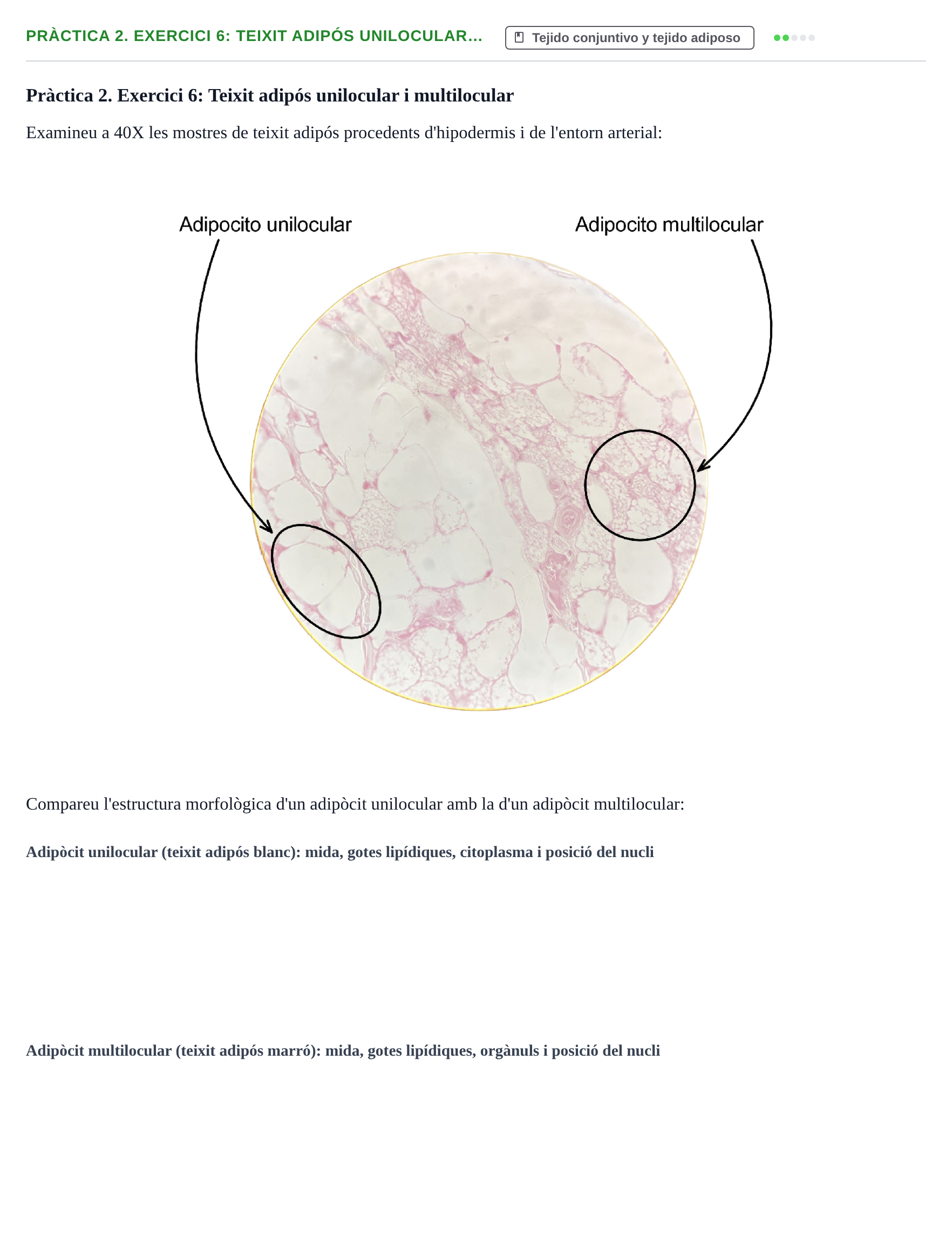 Enunciado: Pràctica 2. Exercici 6: Teixit adipós unilocular…