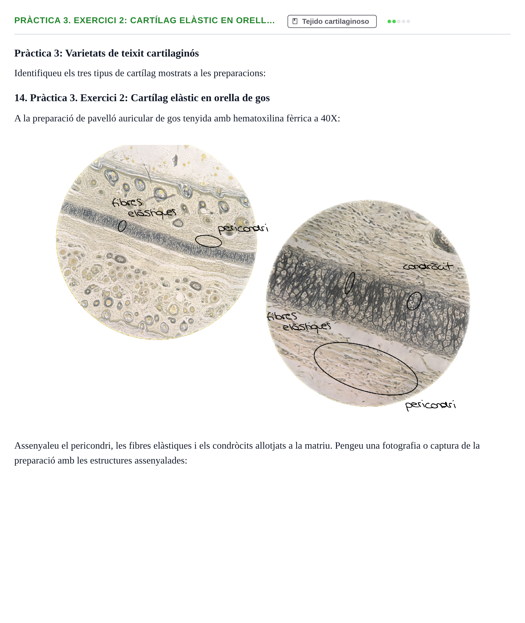 Enunciado: Pràctica 3. Exercici 2: Cartílag elàstic en orell…