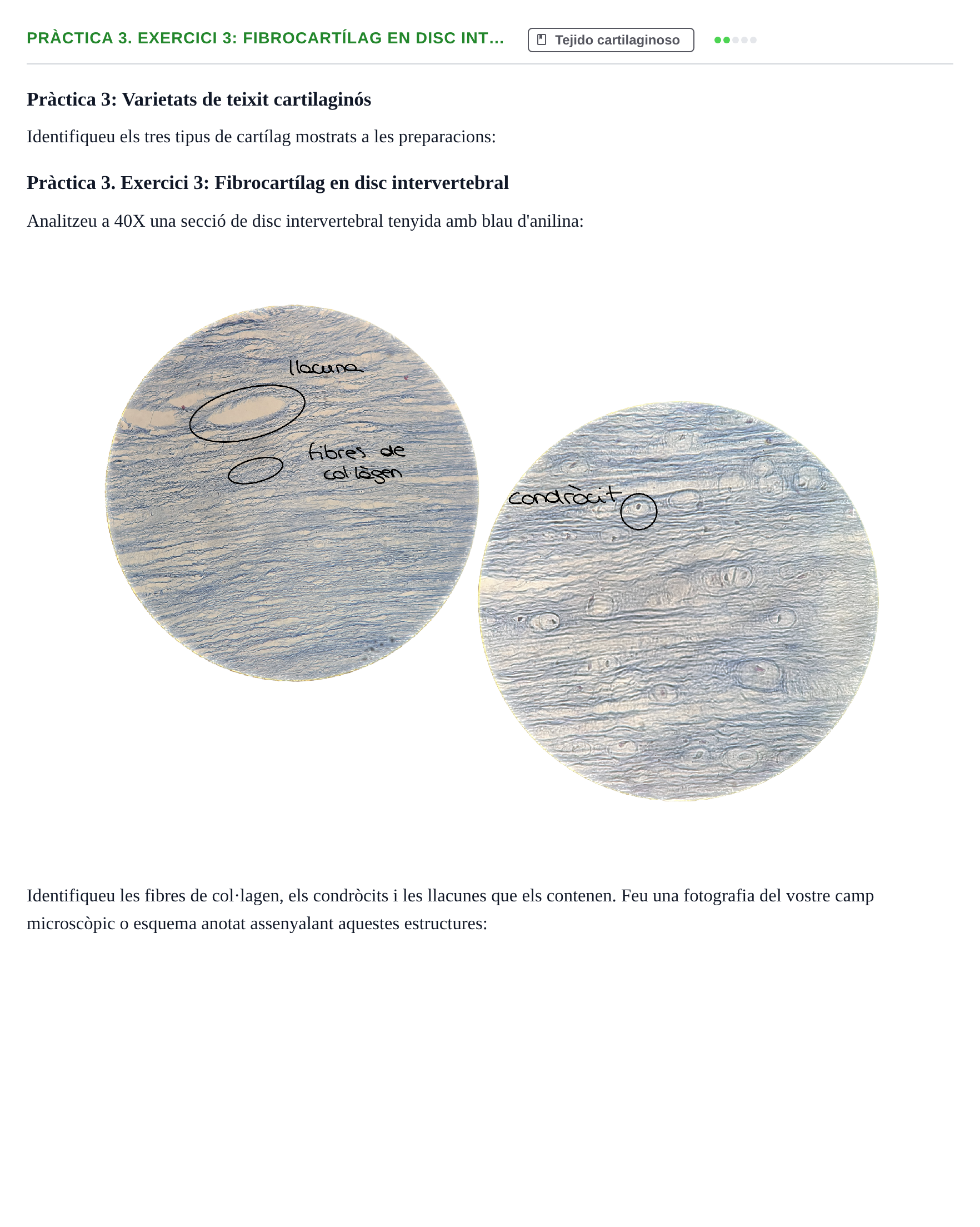 Enunciado: Pràctica 3. Exercici 3: Fibrocartílag en disc int…