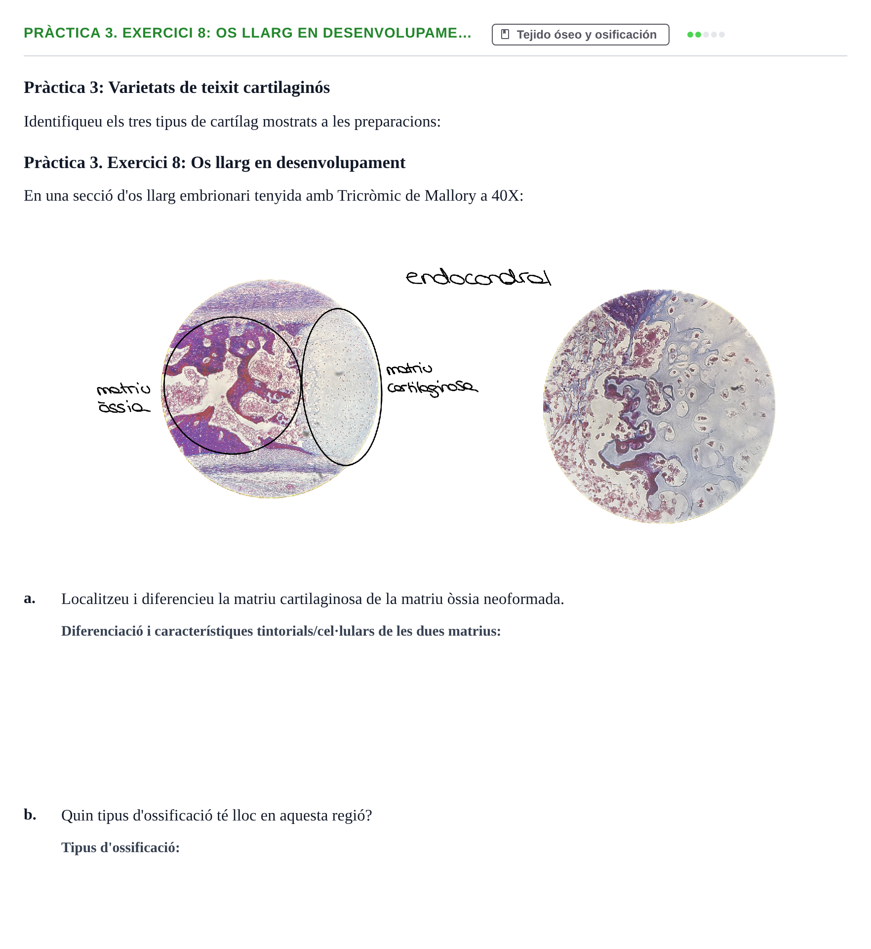 Enunciado: Pràctica 3. Exercici 8: Os llarg en desenvolupame…