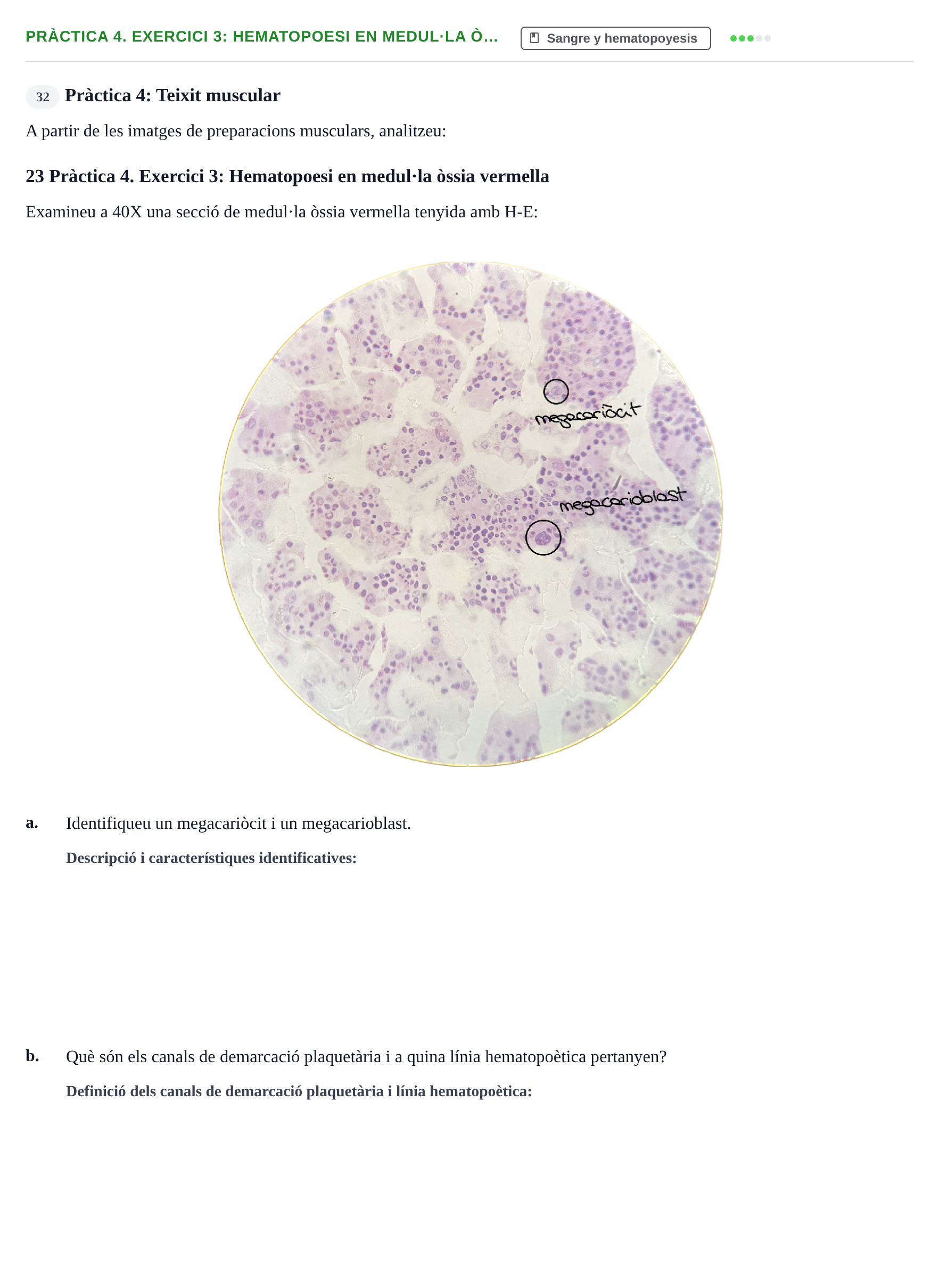 Enunciado: Pràctica 4. Exercici 3: Hematopoesi en medul·la ò…