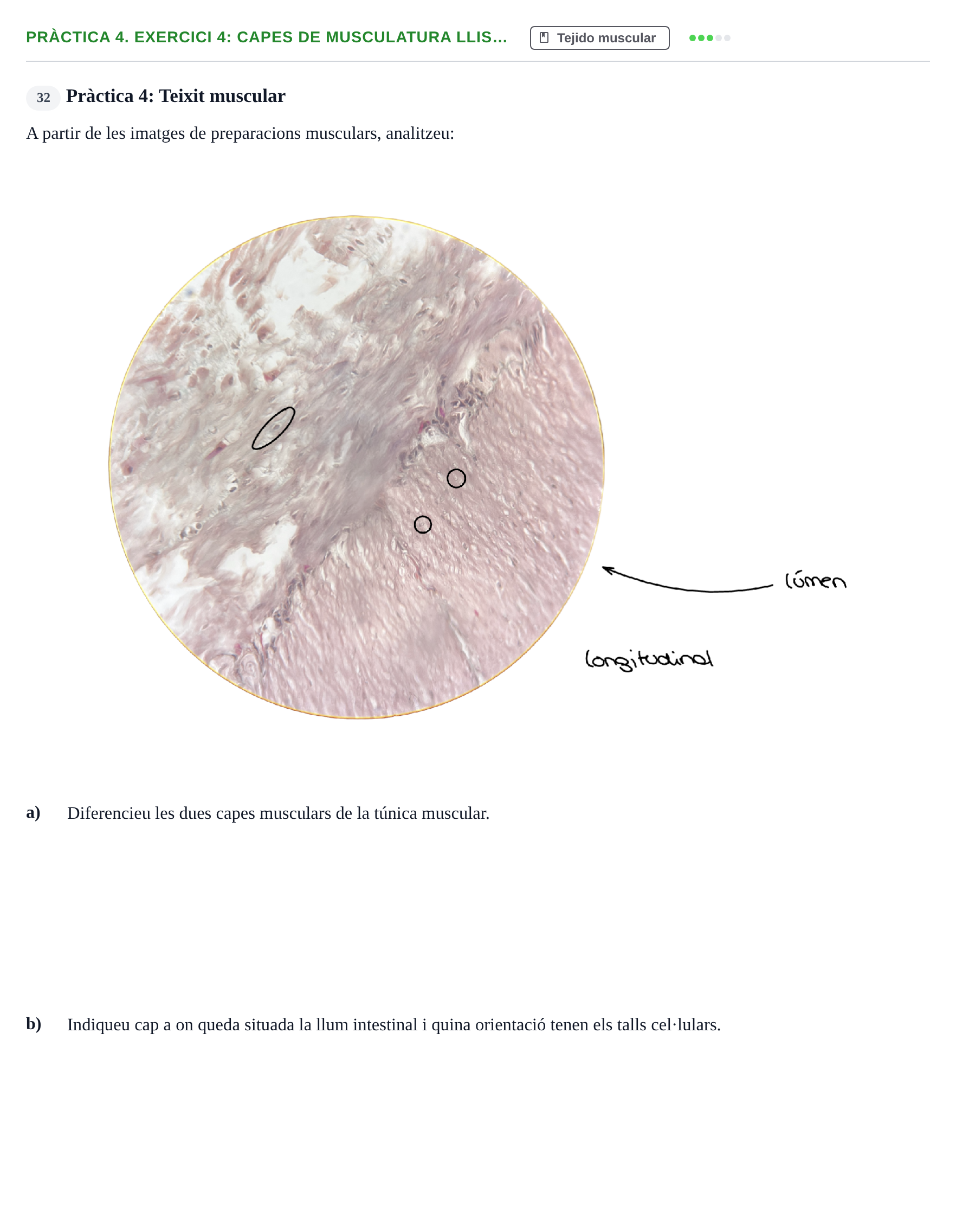 Enunciado: Pràctica 4. Exercici 4: Capes de musculatura llis…