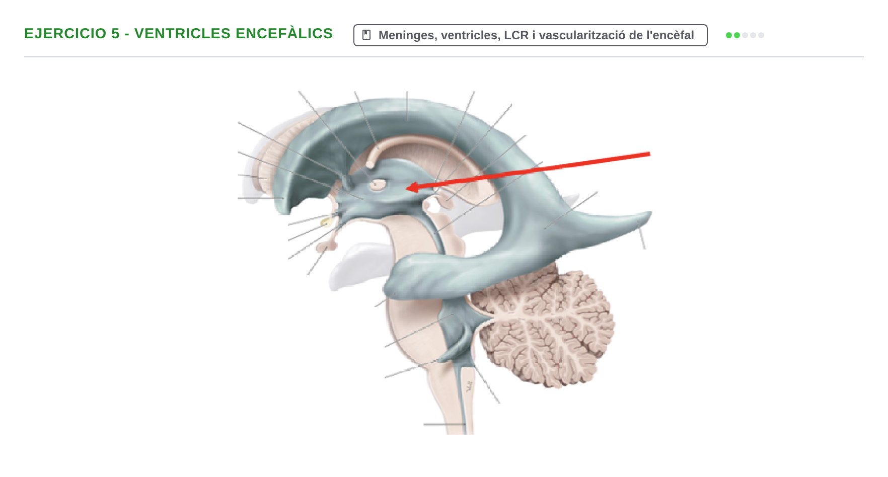 Enunciado: 5 - Ventricles encefàlics