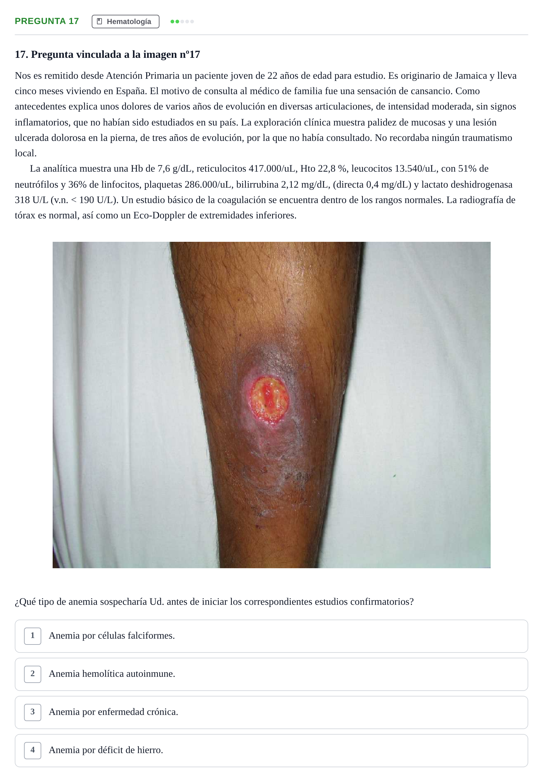 Enunciado: Pregunta 17 · MIR 2017 — Anemia hemolítica con úlcera maleolar: diagnóstico