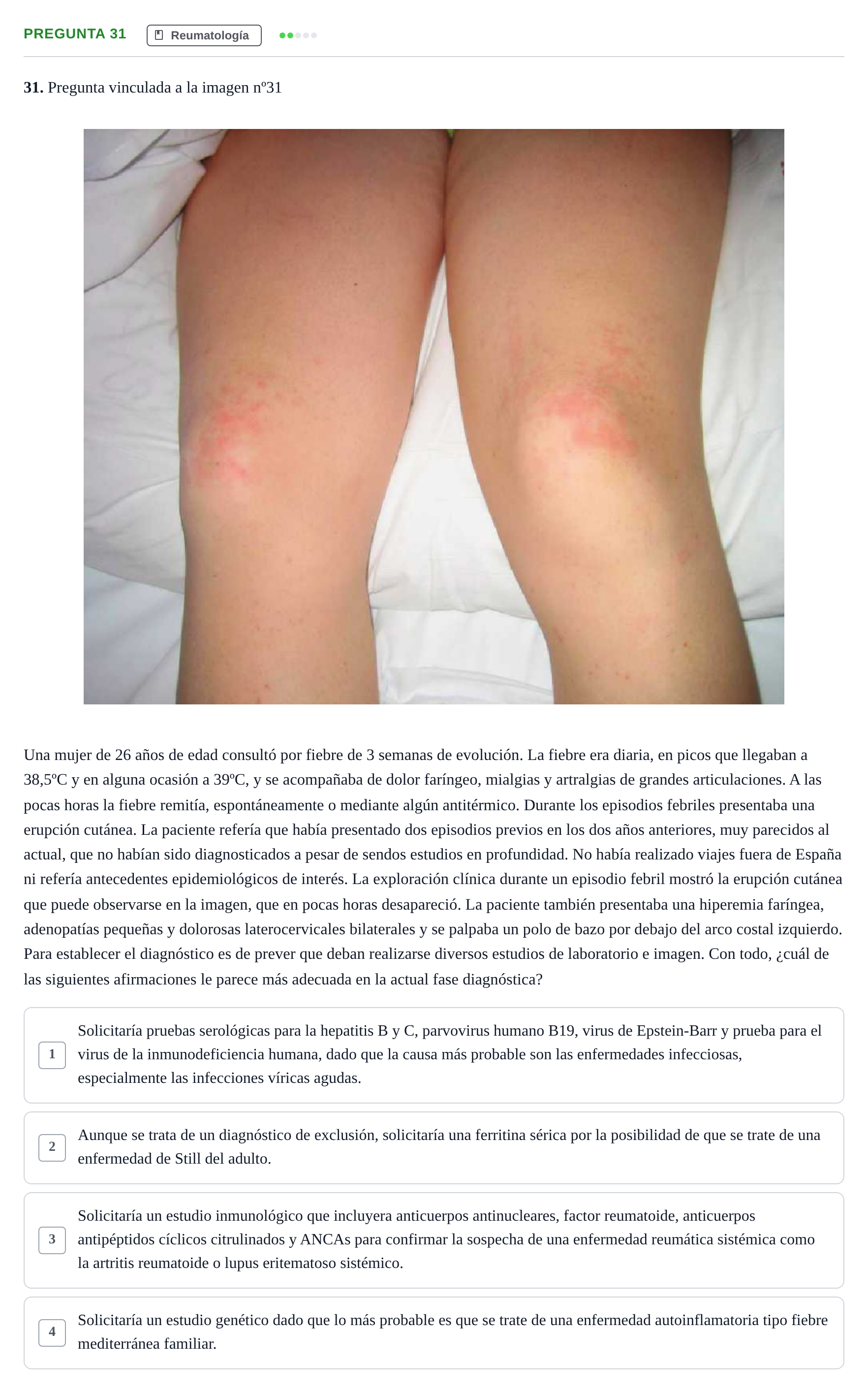 Enunciado: Pregunta 31 · MIR 2017 · Reumatología