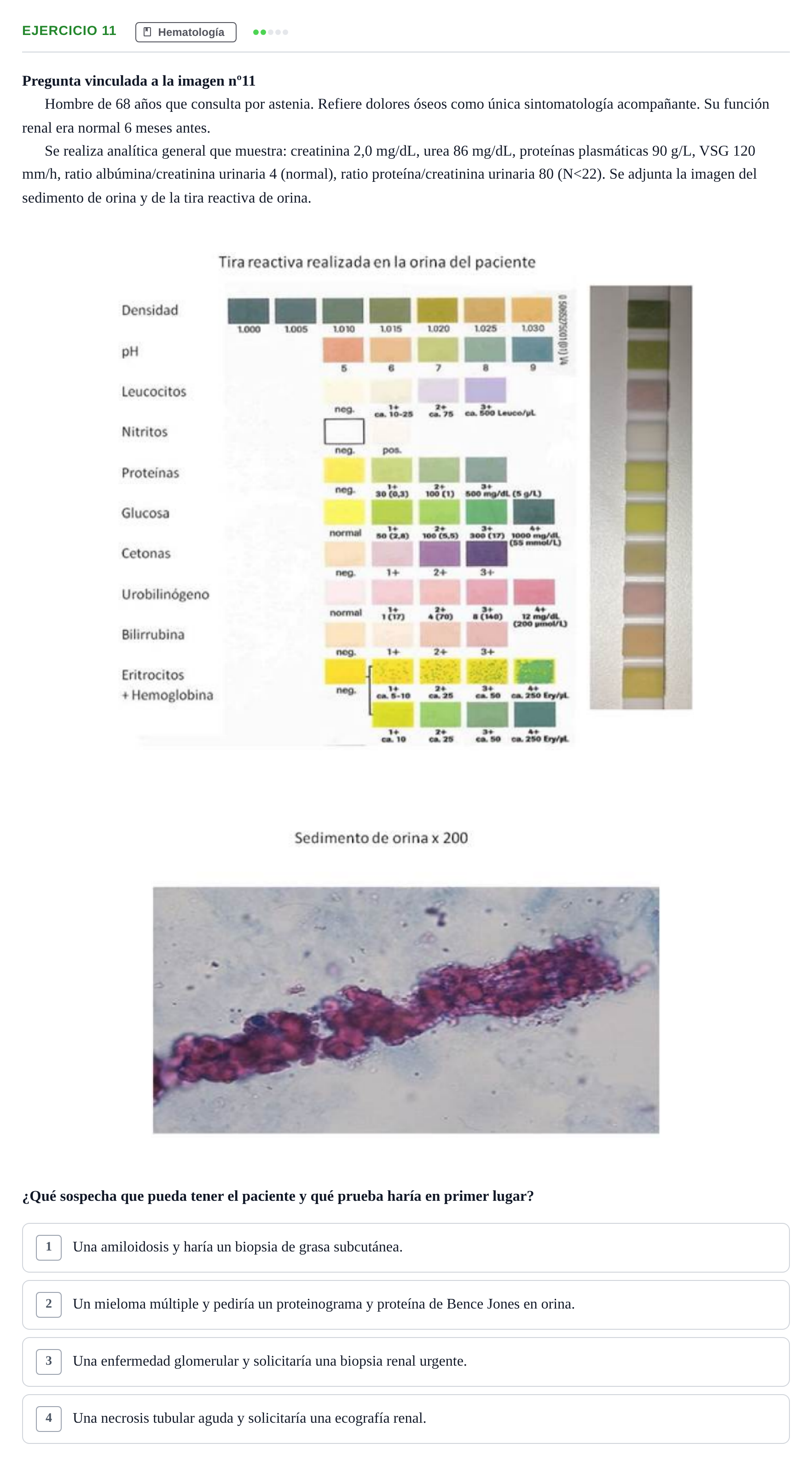 Enunciado: Pregunta 11 · MIR 2018 — Insuficiencia renal con proteinuria no albuminúrica: sospecha y