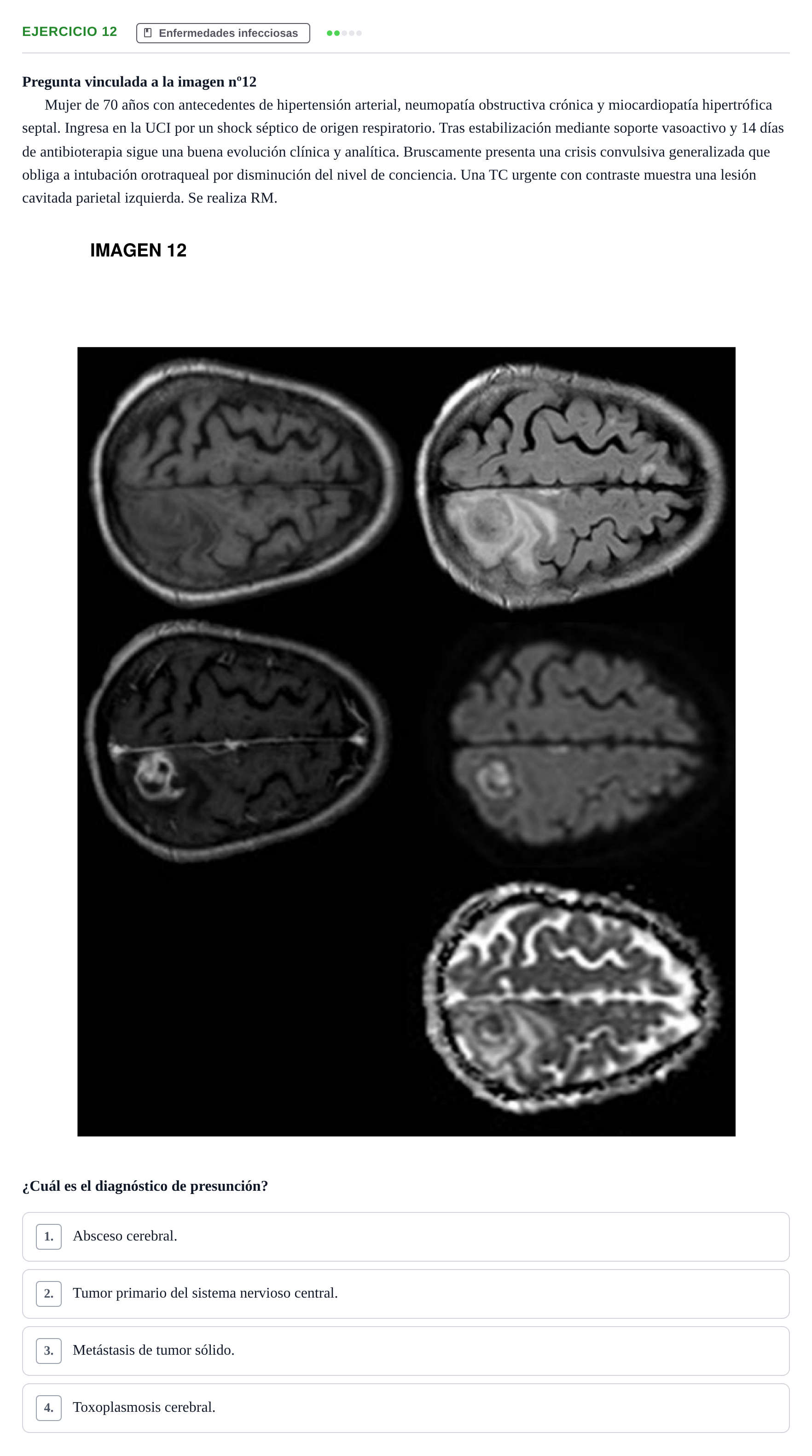 Enunciado: Pregunta 12 · MIR 2018 · Enfermedades infecciosas