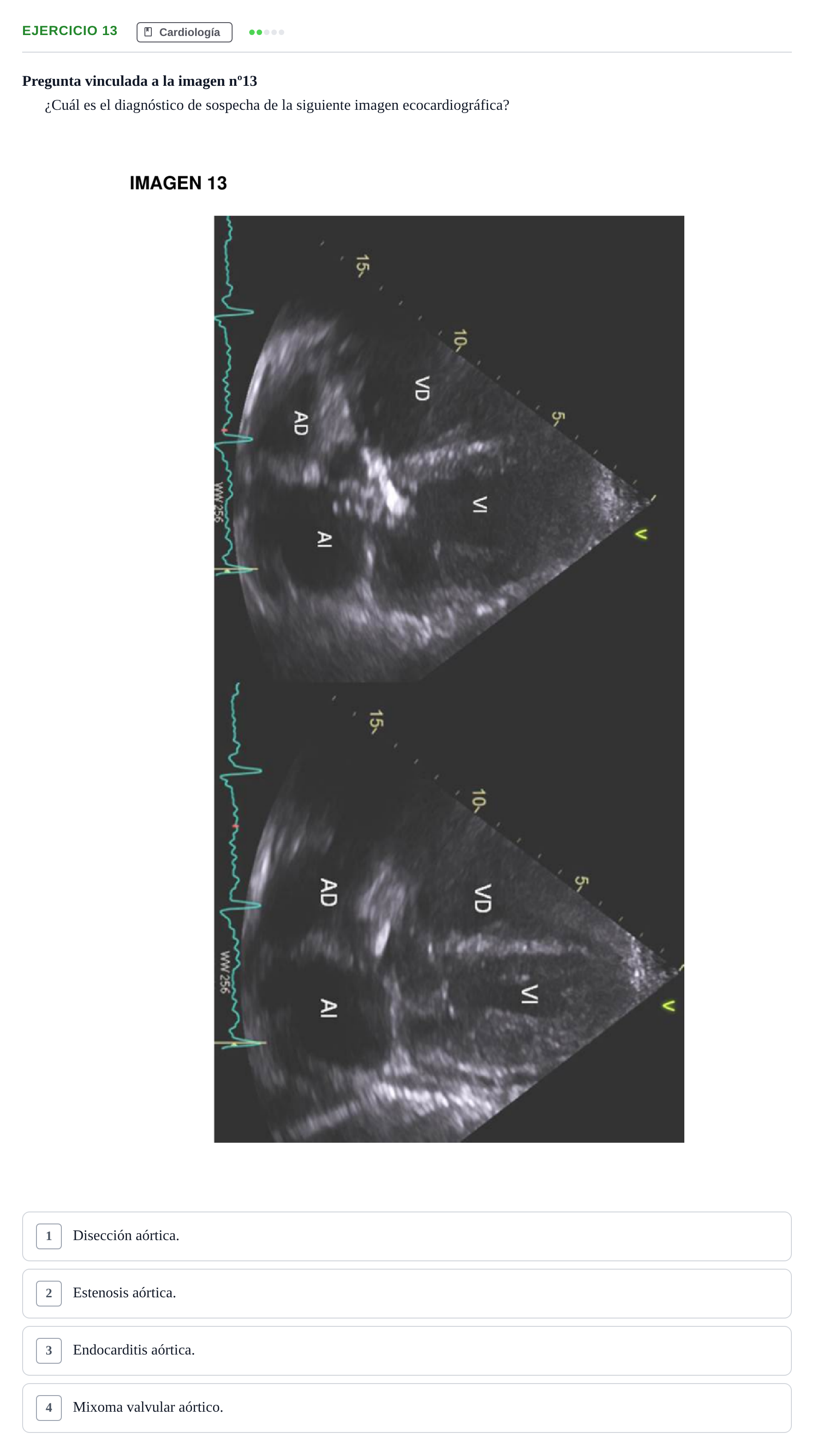 Enunciado: Pregunta 13 · MIR 2018 · Cardiología