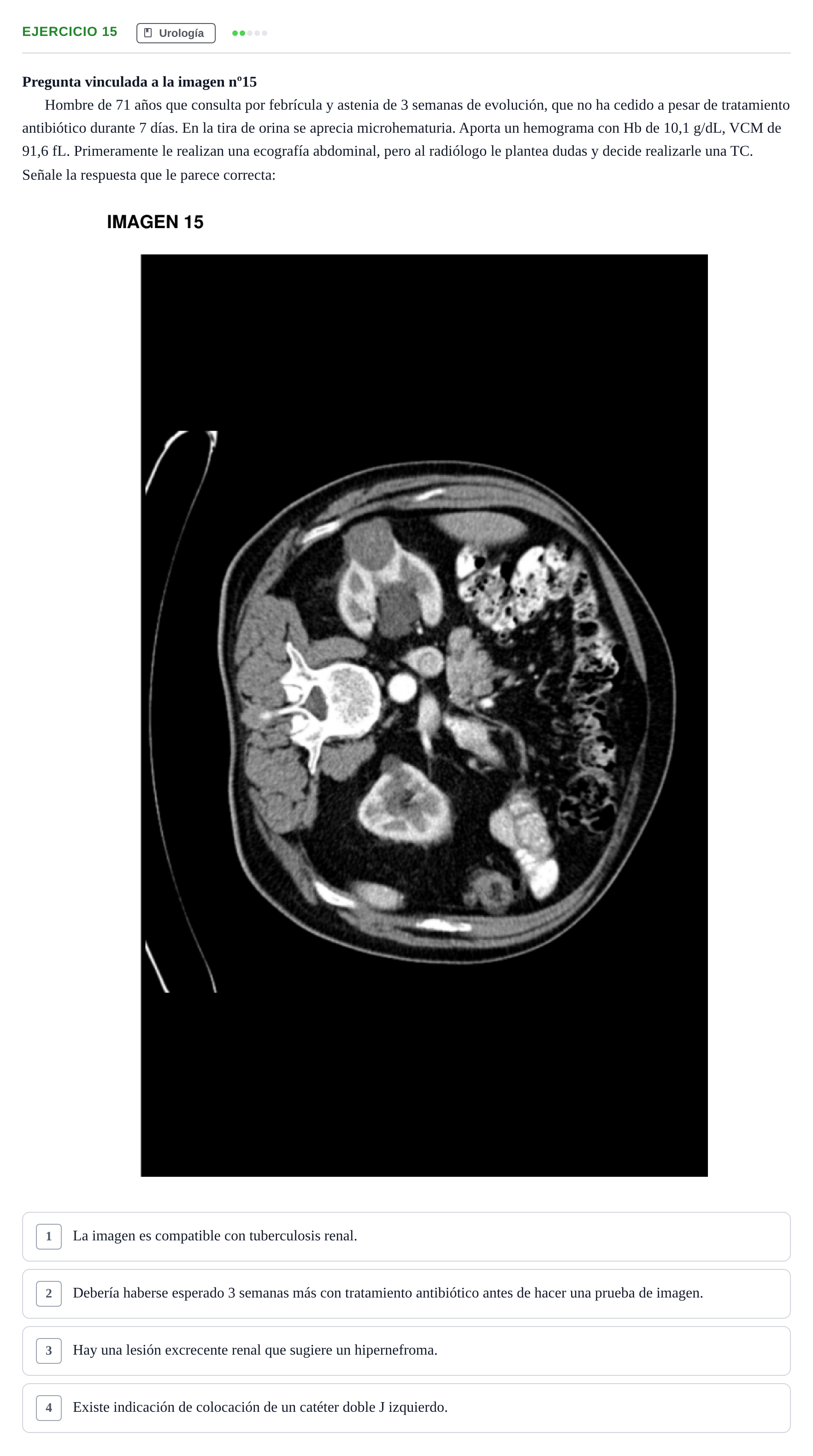 Enunciado: Pregunta 15 · MIR 2018 · Urología