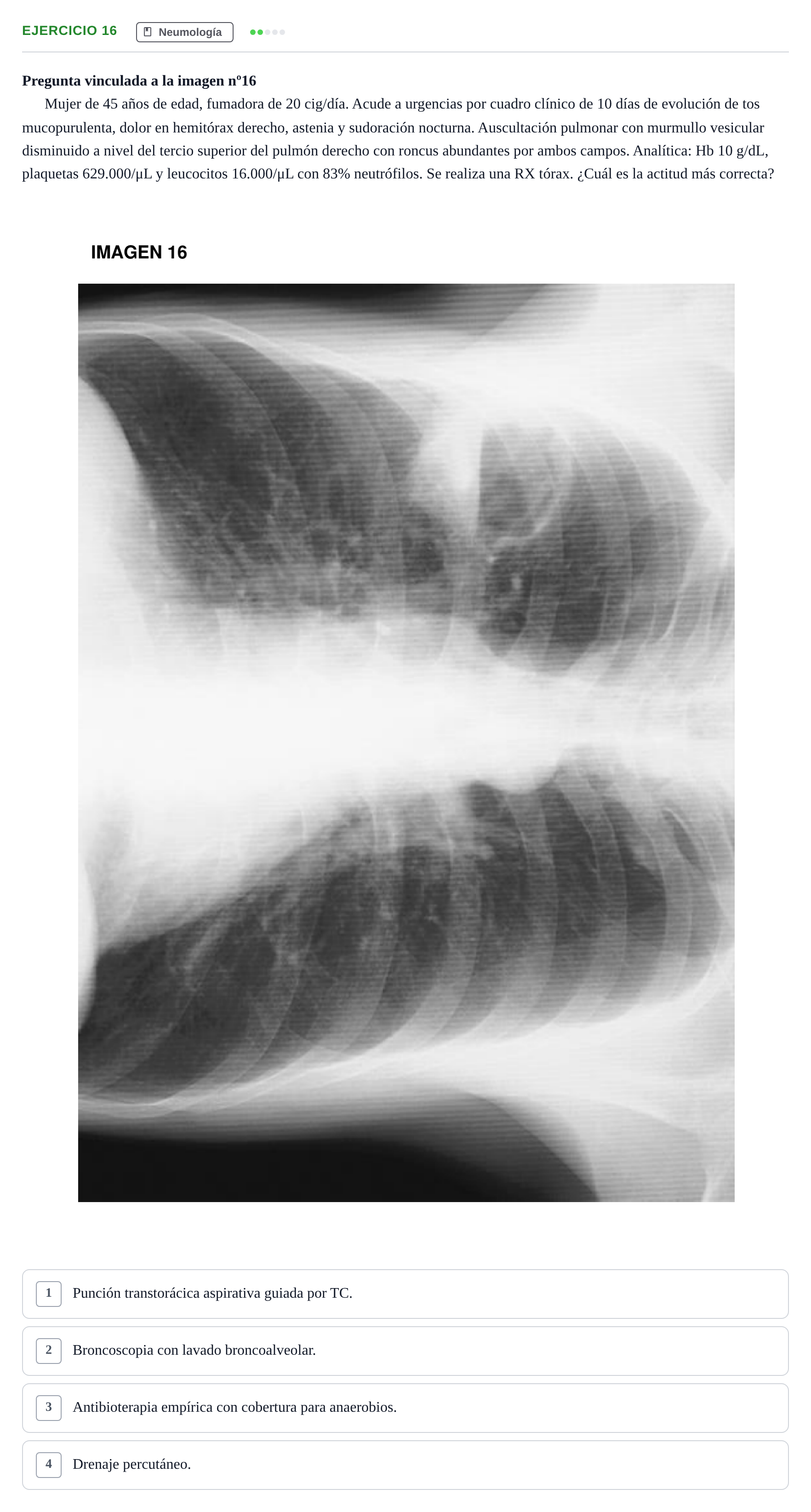 Enunciado: Pregunta 16 · MIR 2018 — Absceso pulmonar con nivel hidroaéreo: tratamiento