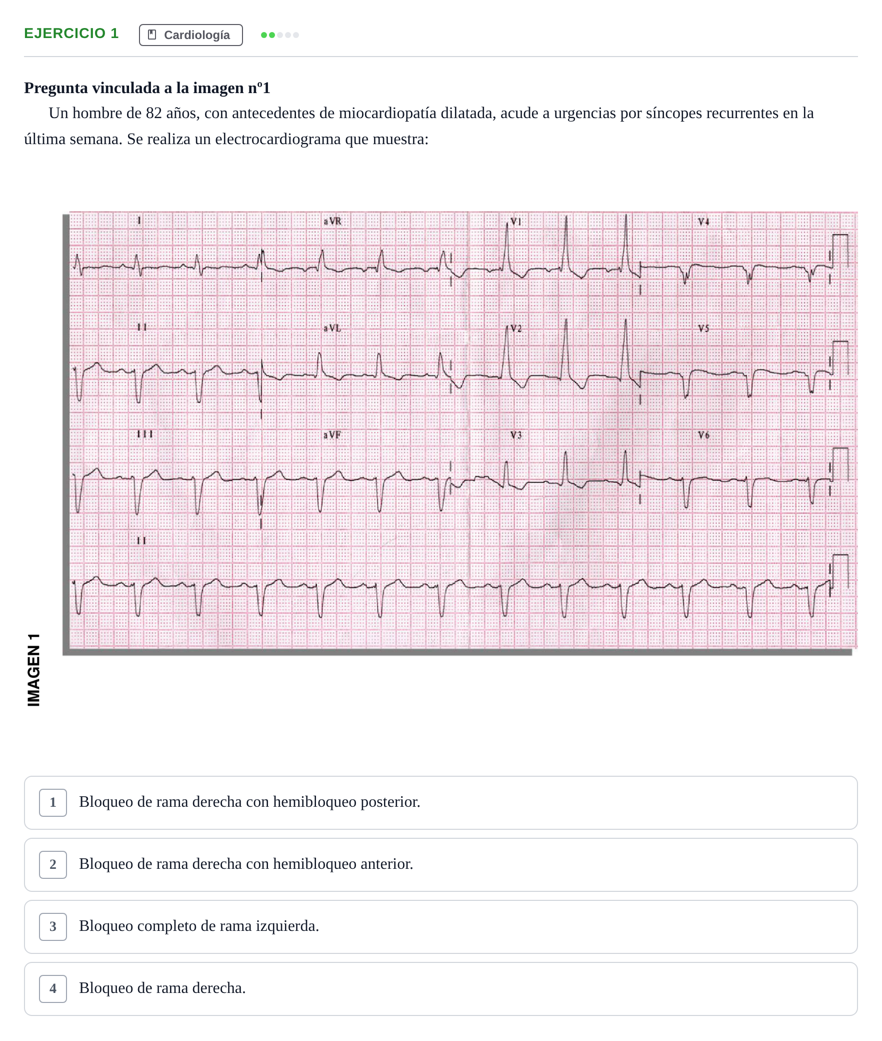 Enunciado: Pregunta 1 · MIR 2018 — Trastorno de la conducción en el ECG con síncope