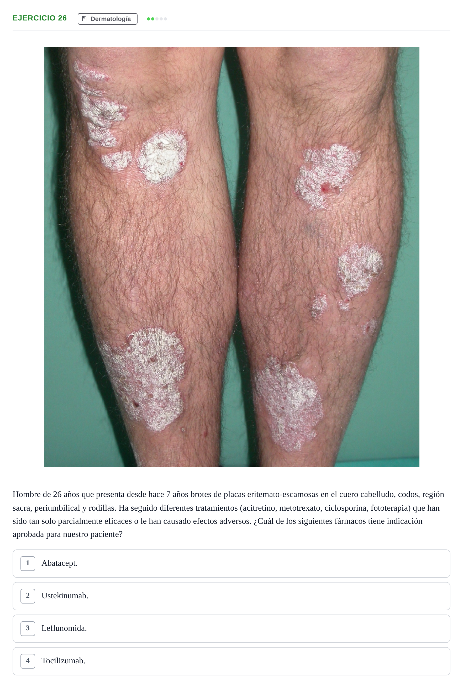 Enunciado: Pregunta 26 · MIR 2018 — Psoriasis refractaria a tratamiento sistémico: fármaco indicado