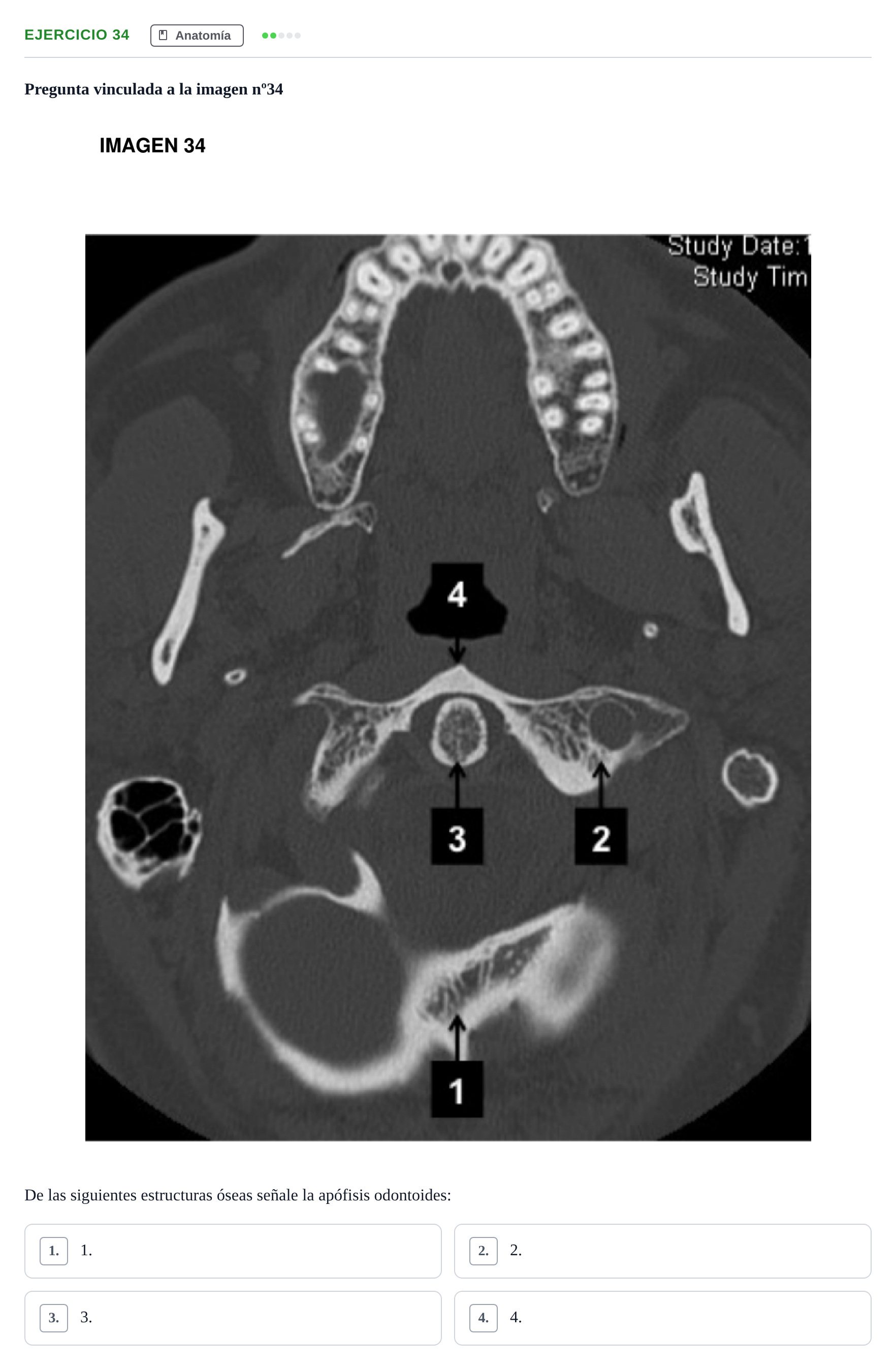 Enunciado: Pregunta 34 · MIR 2018 — Identificación de la apófisis odontoides en TC
