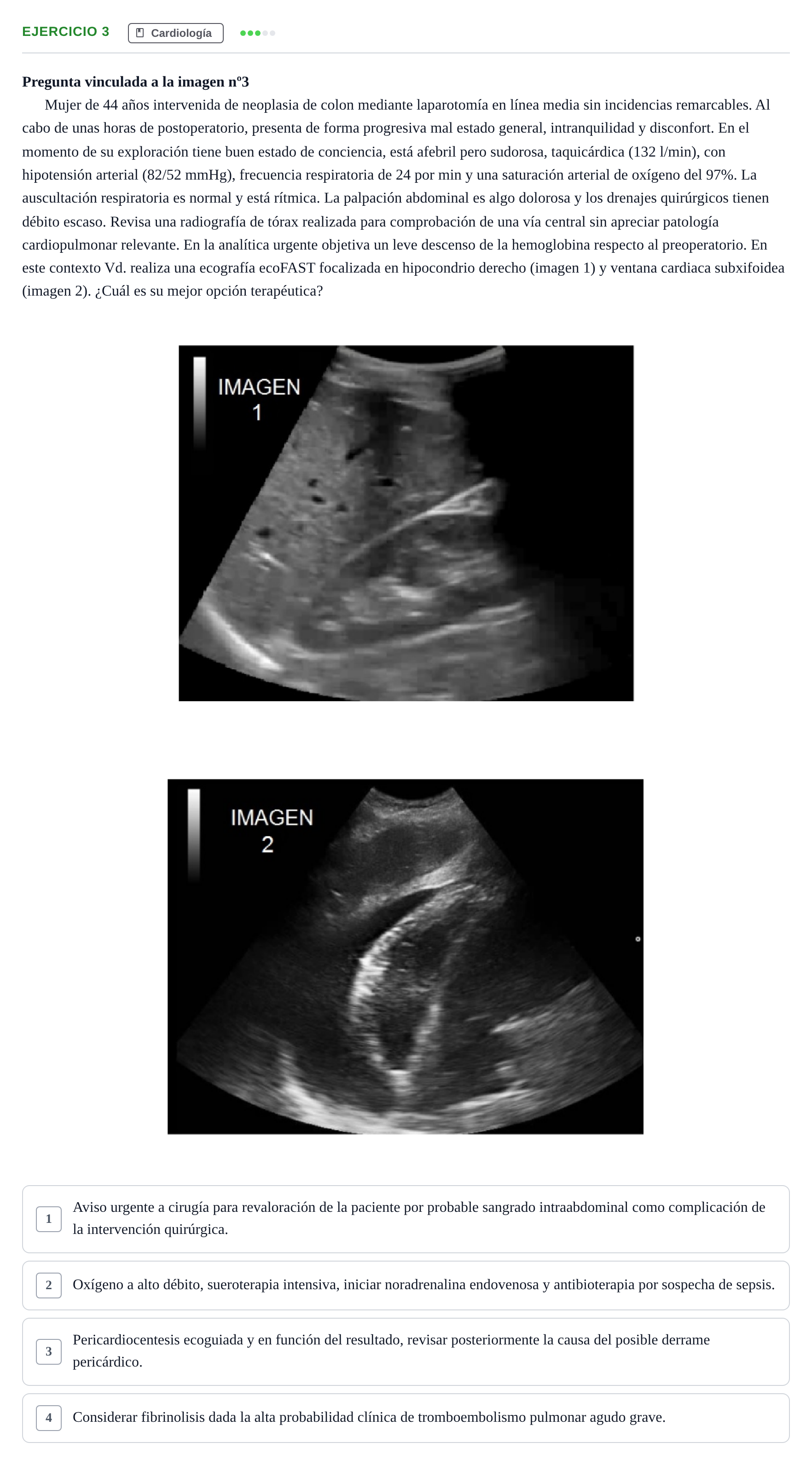 Enunciado: Pregunta 3 · MIR 2018 · Cardiología
