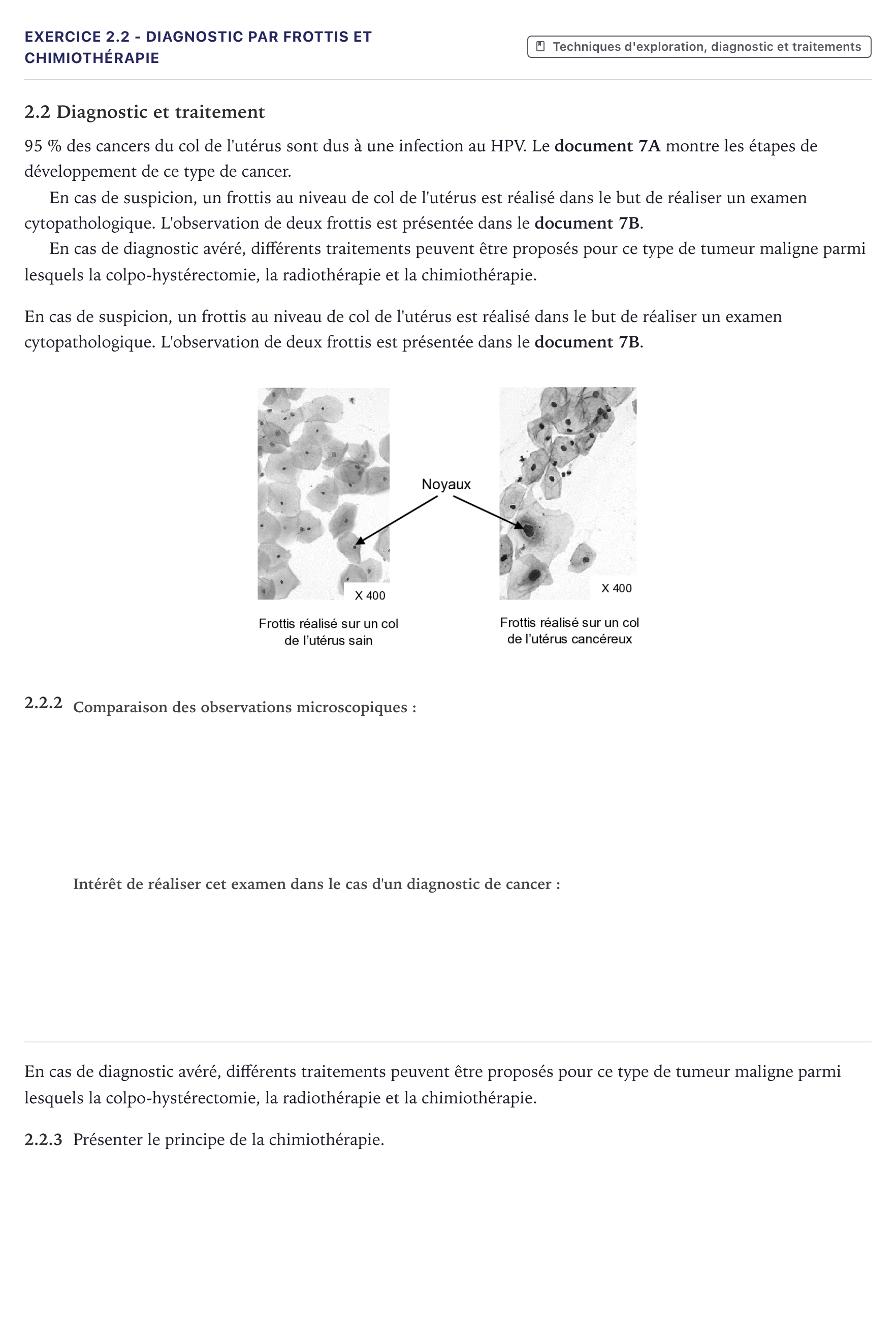 Énoncé: Exercice 2.2 - Diagnostic par frottis et chimiothérapie · Bac ST2S Chimie, Biologie et Physiopathologie Humaines Métropole 2025
