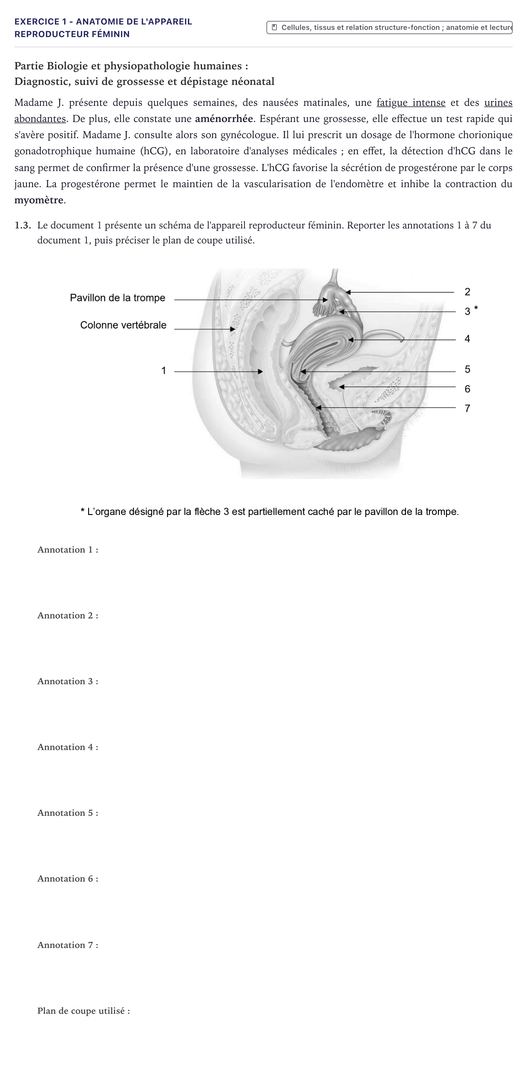 Énoncé: Exercice 1 - Anatomie de l'appareil reproducteur féminin · Bac ST2S Chimie, Biologie et Physiopathologie Humaines Métropole 2023