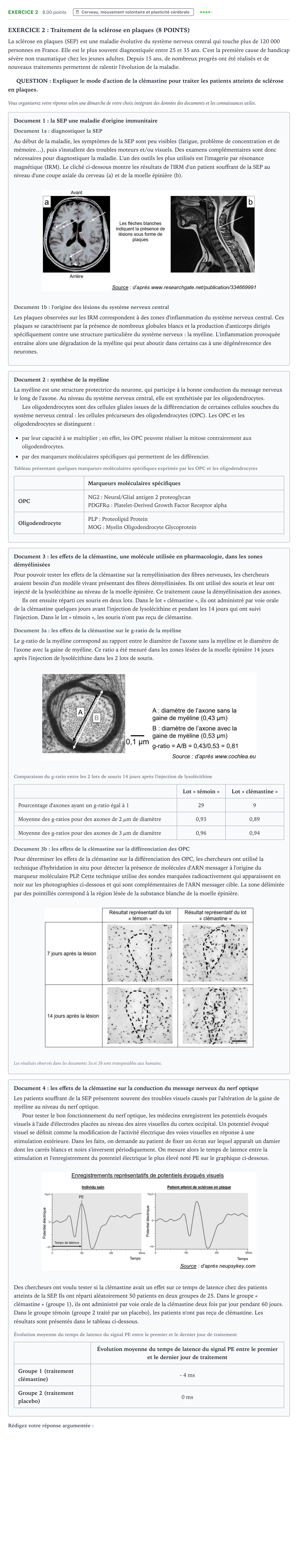 Énoncé: Exercice 2 · Bac Sciences de la Vie et de la Terre Métropole 1 remplacement 2024
