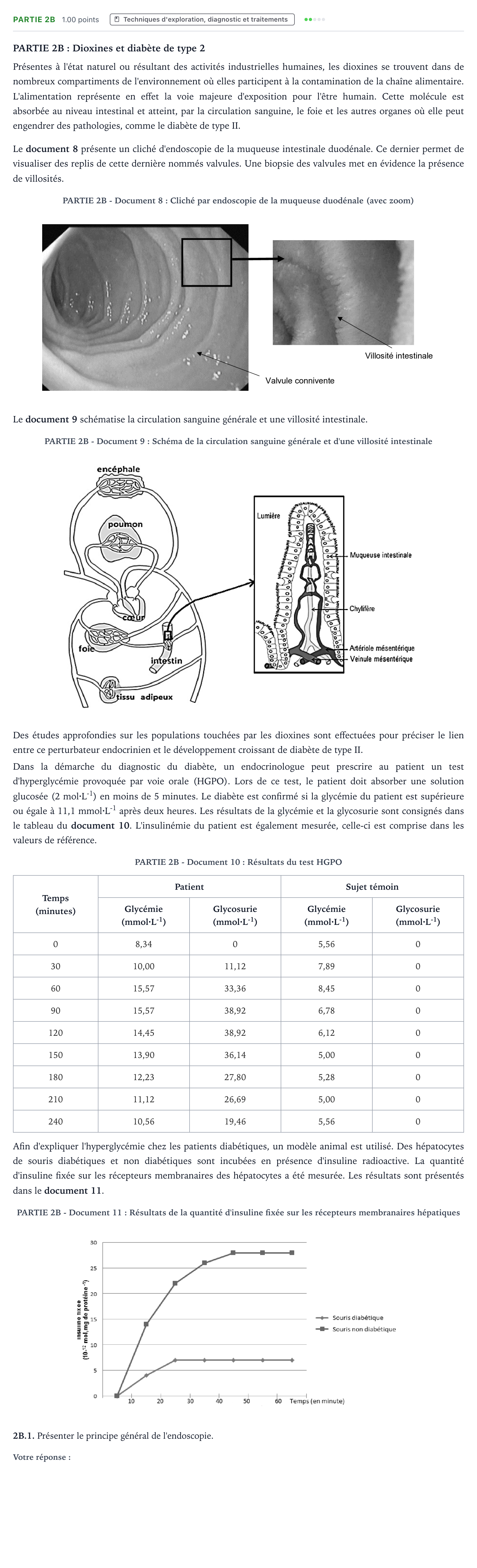 Énoncé: Partie 2B - Techniques d'exploration · Bac ST2S Chimie, Biologie et Physiopathologie Humaines Métropole Candidat libre 2021