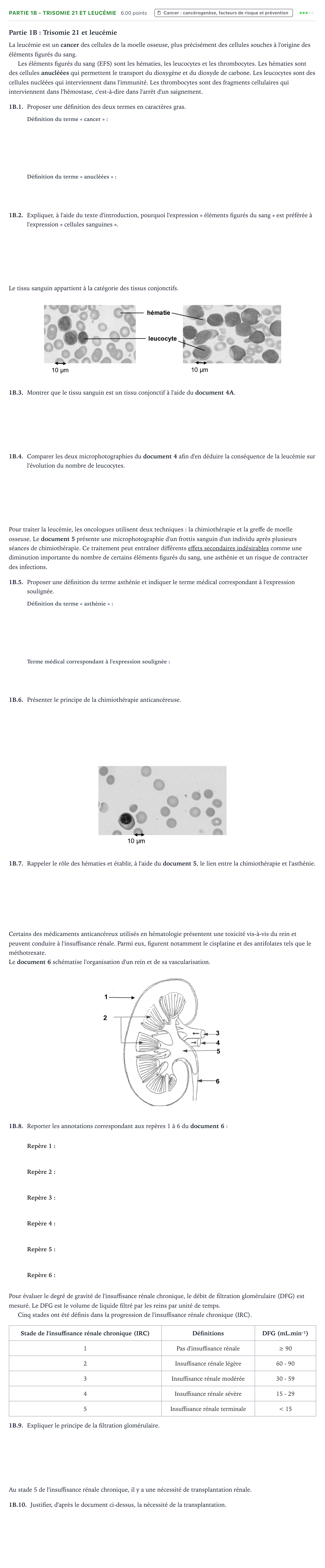 Énoncé: Partie 1B - Trisomie 21 et leucémie · Bac ST2S Chimie, Biologie et Physiopathologie Humaines Métropole remplacement 2021