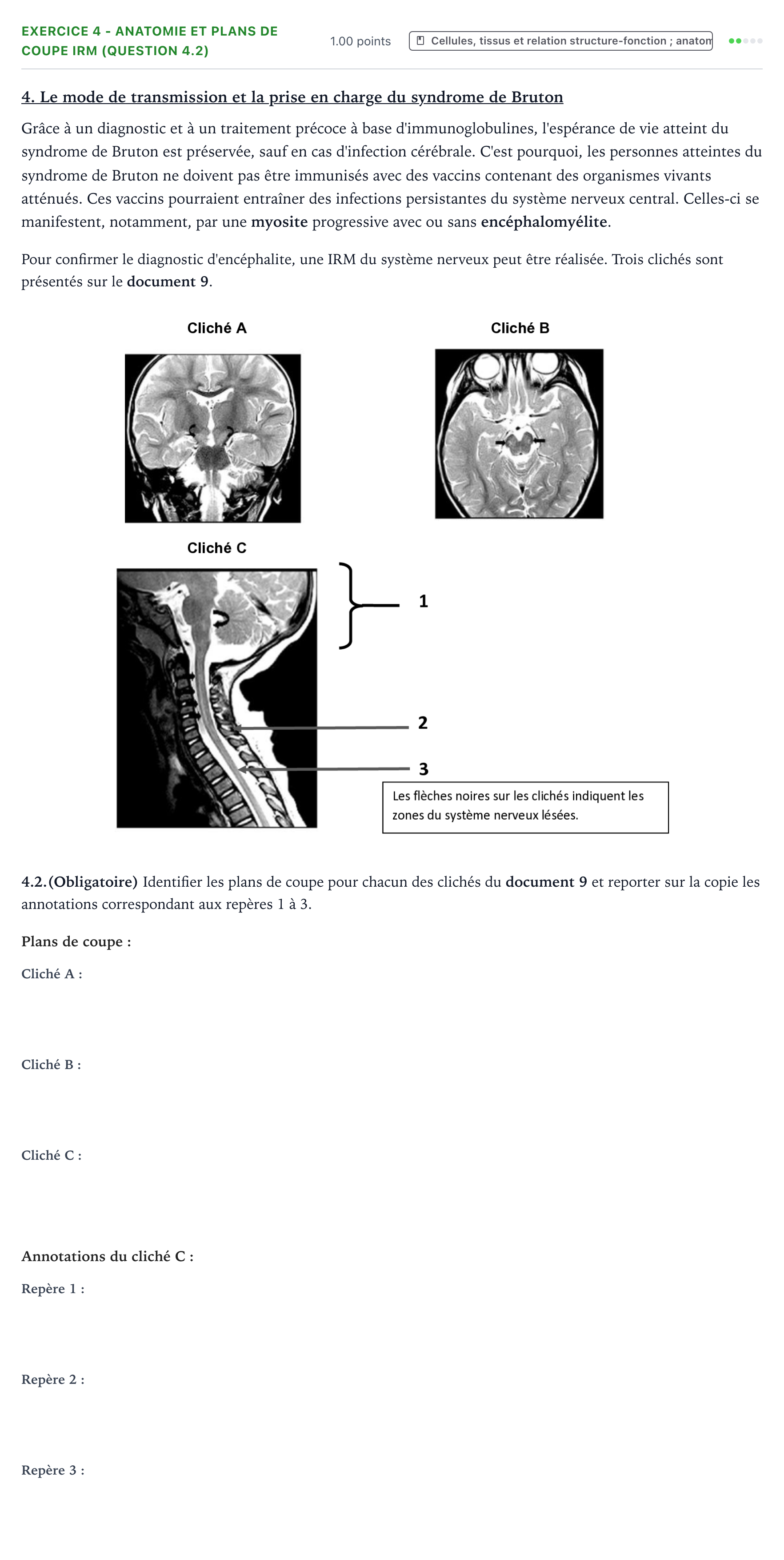 Énoncé: Exercice 4 - Anatomie et plans de coupe IRM (question 4.2) · Bac ST2S Chimie, Biologie et Physiopathologie Humaines Métropole remplacement 2022