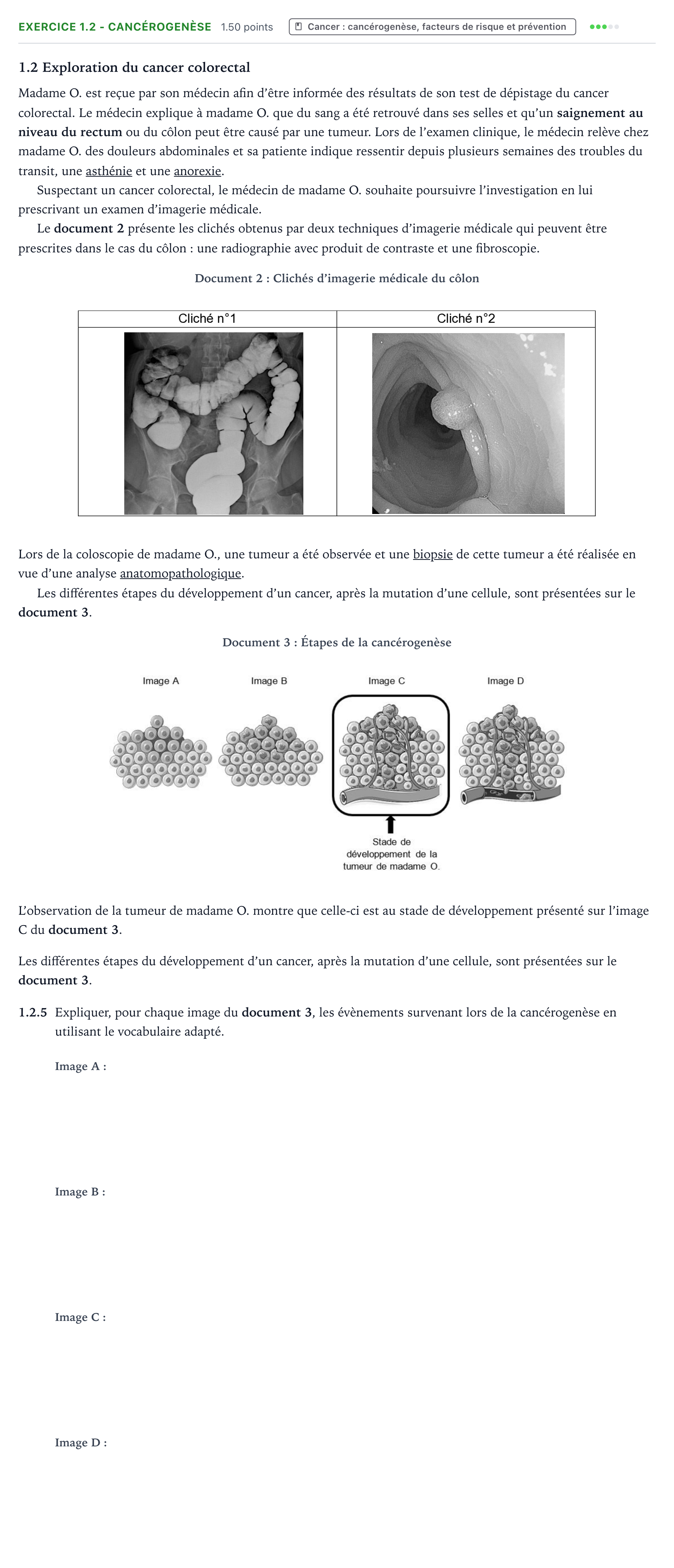 Énoncé: Exercice 1.2 - Cancérogenèse · Bac ST2S Chimie, Biologie et Physiopathologie Humaines Métropole remplacement 2024